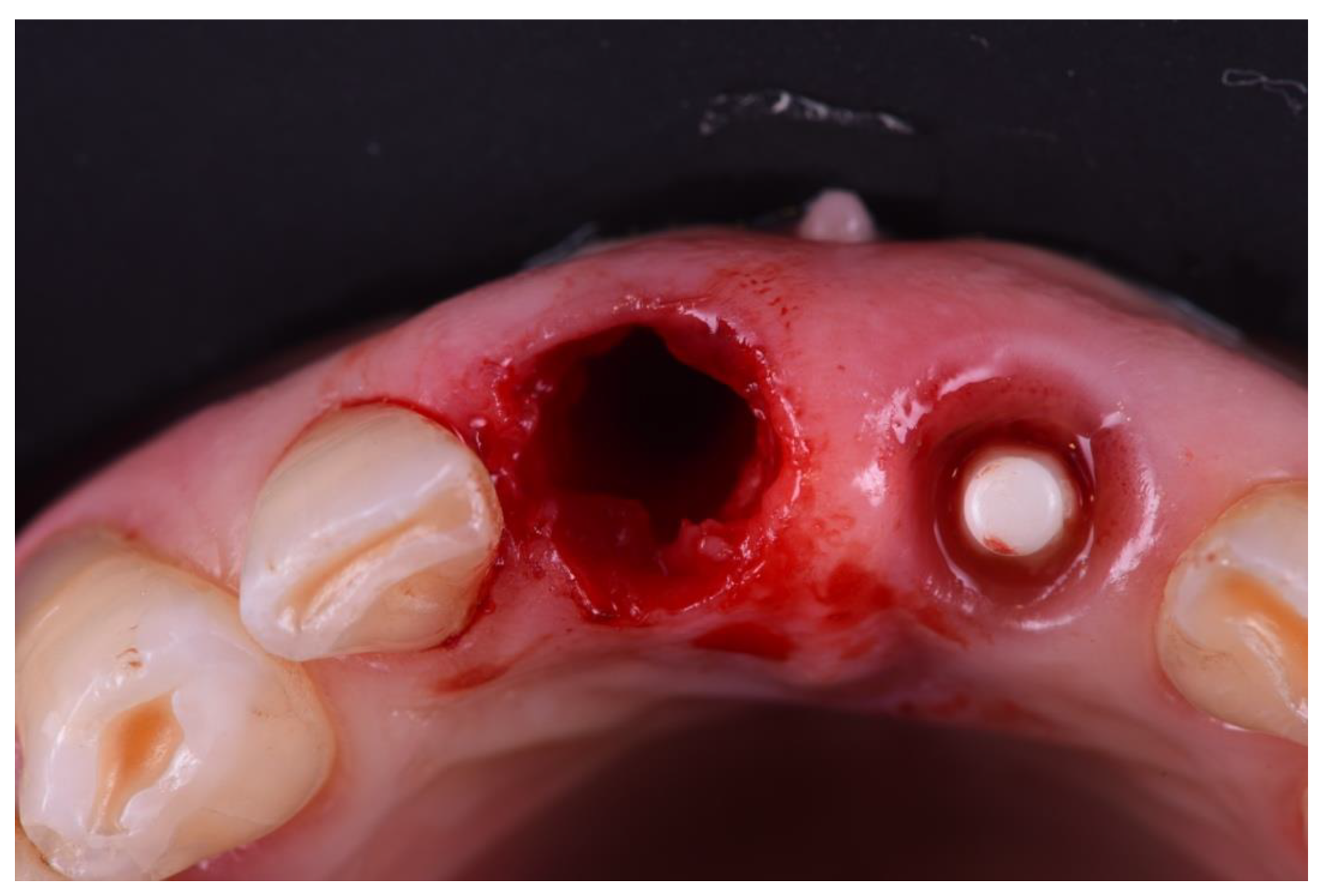 Prosthesis 05 00074 g007