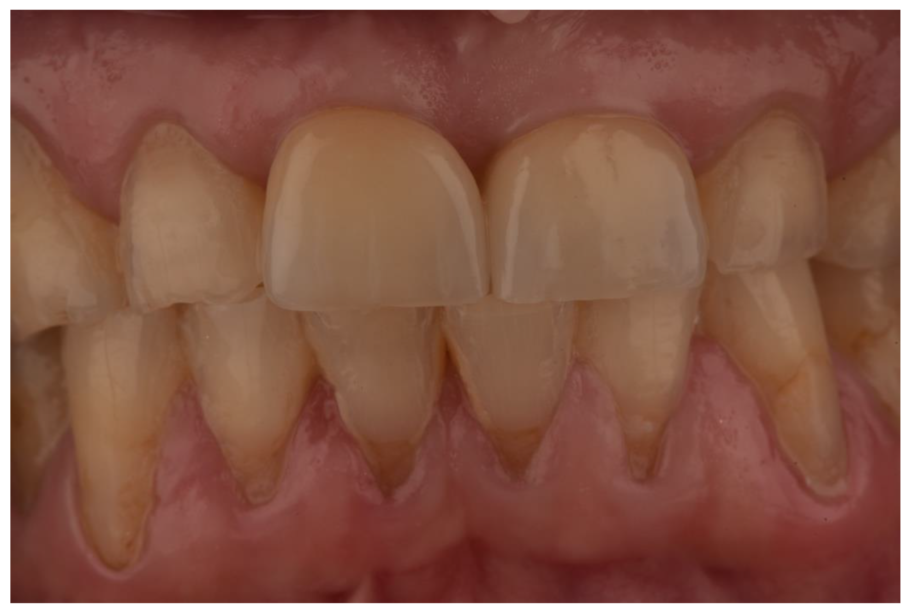 Prosthesis 05 00074 g010