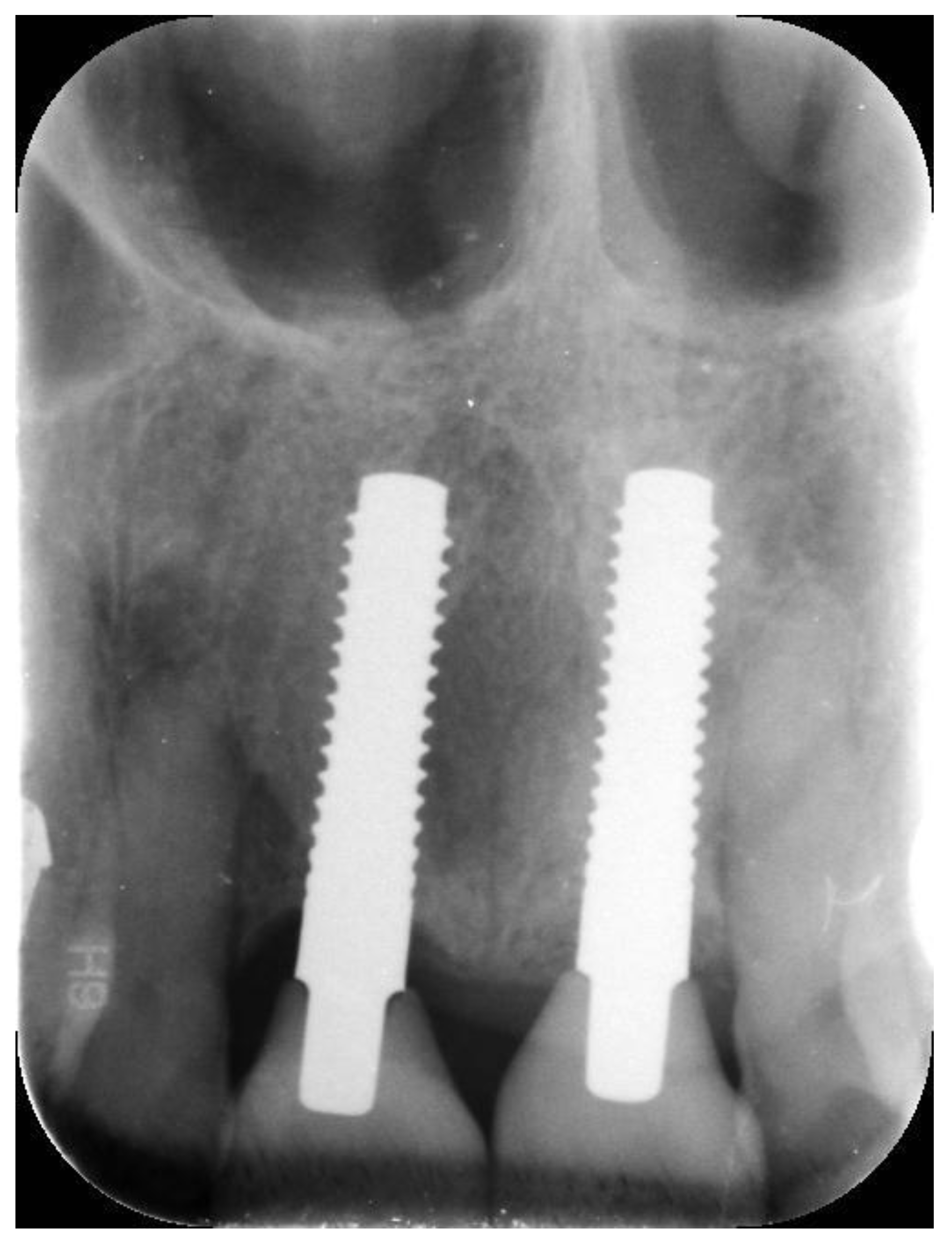 Prosthesis 05 00074 g011