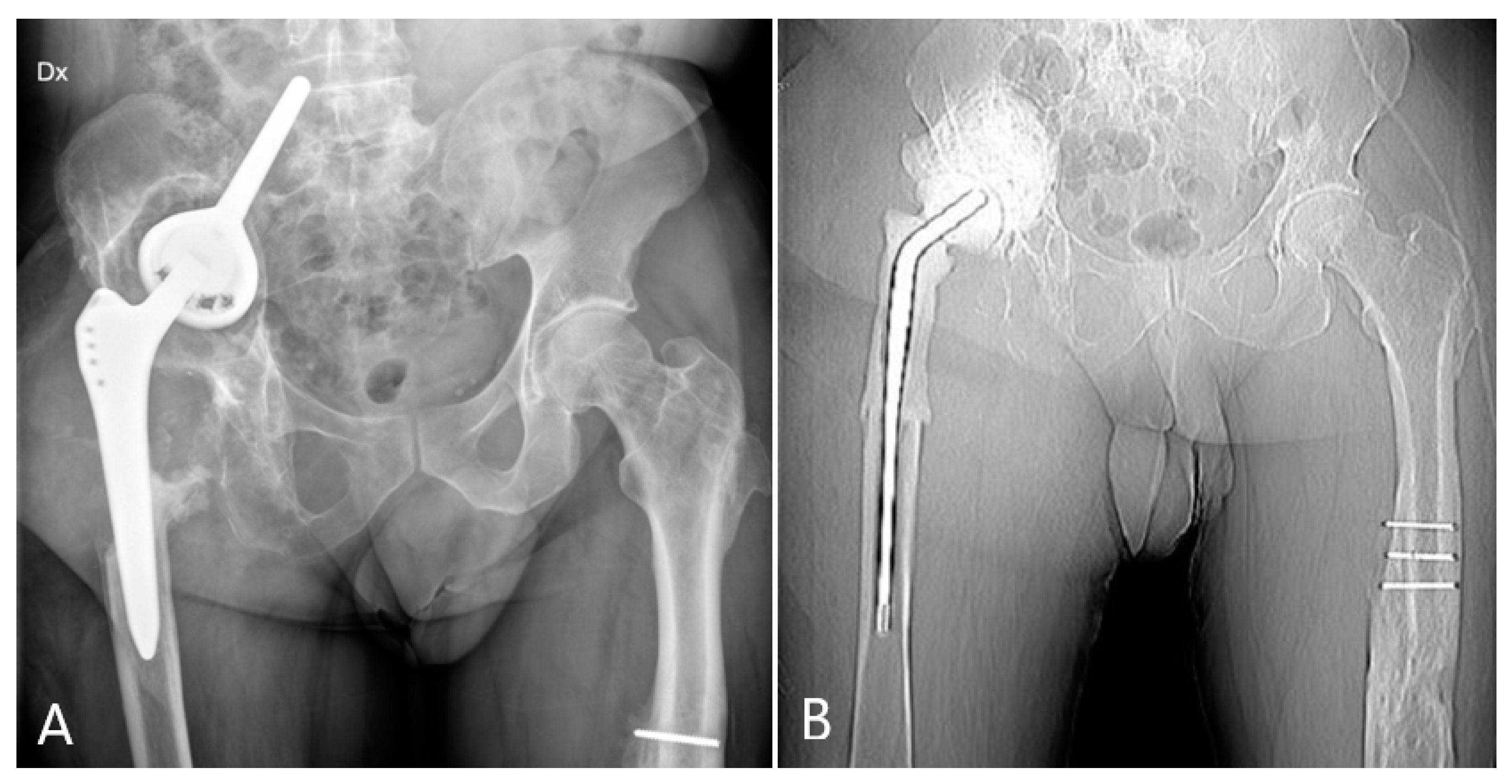 Prosthesis 05 00076 g002