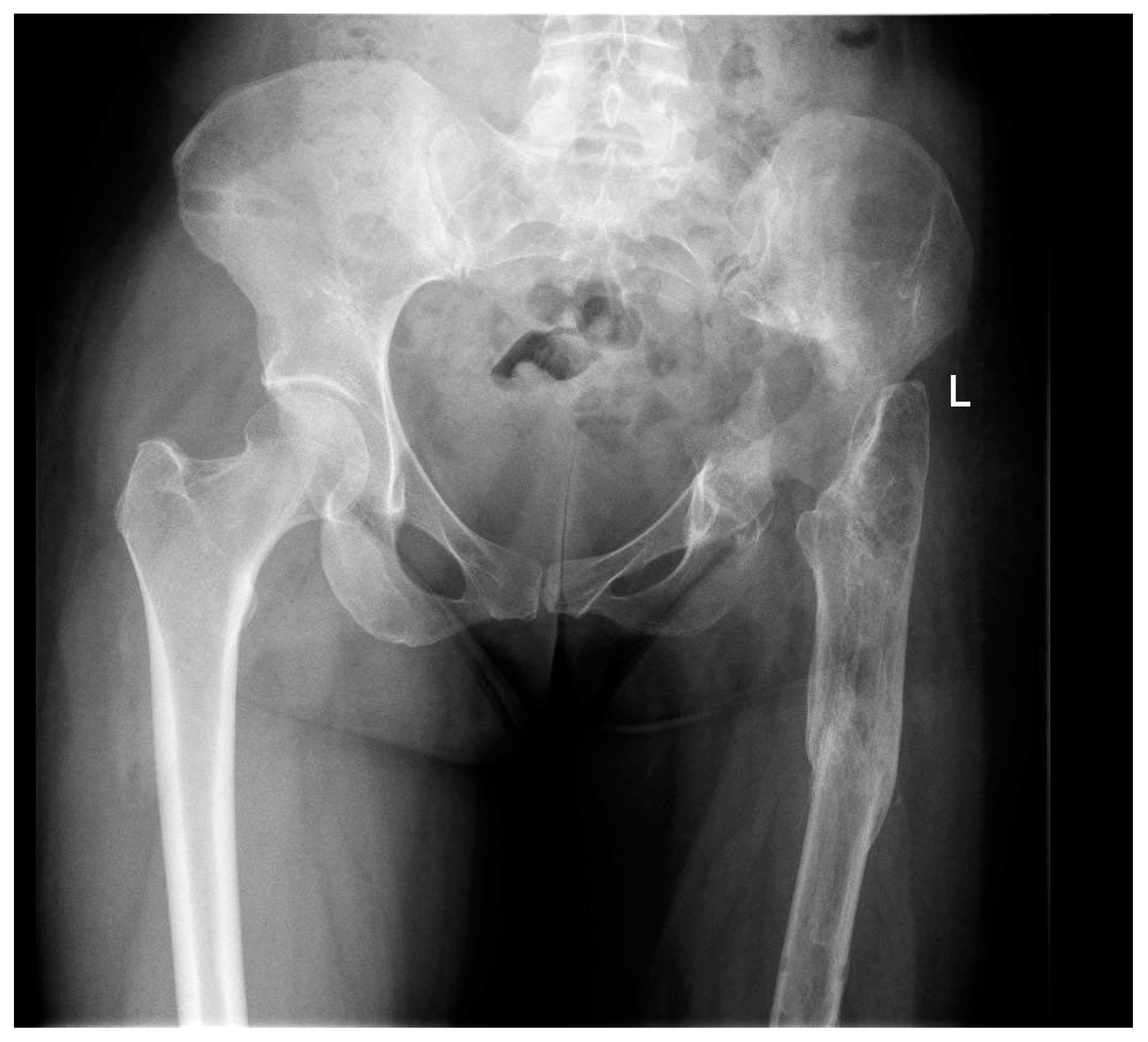 Prosthesis 05 00076 g005