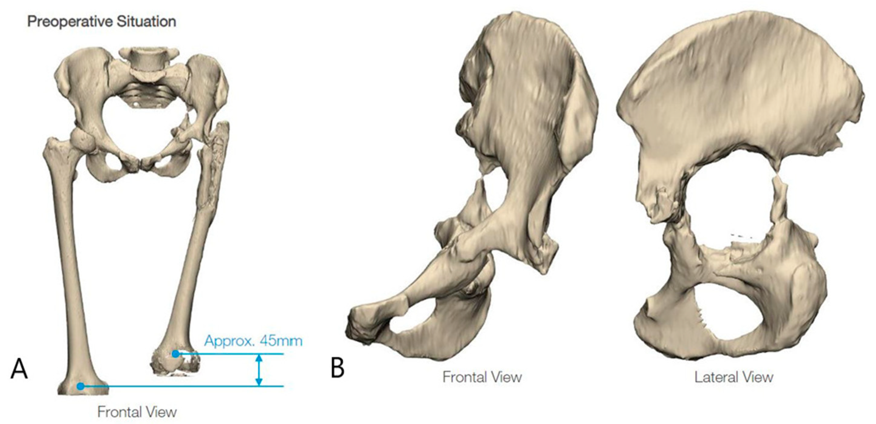 Prosthesis 05 00076 g006
