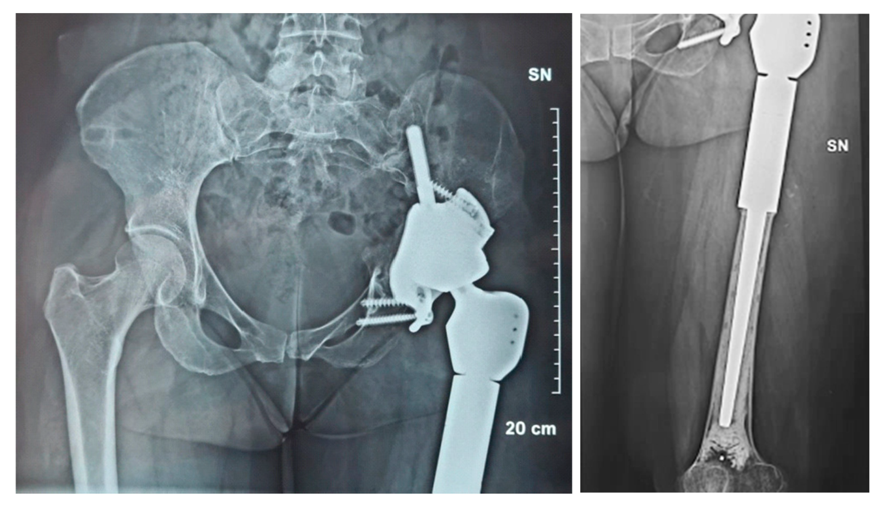 Prosthesis 05 00076 g008