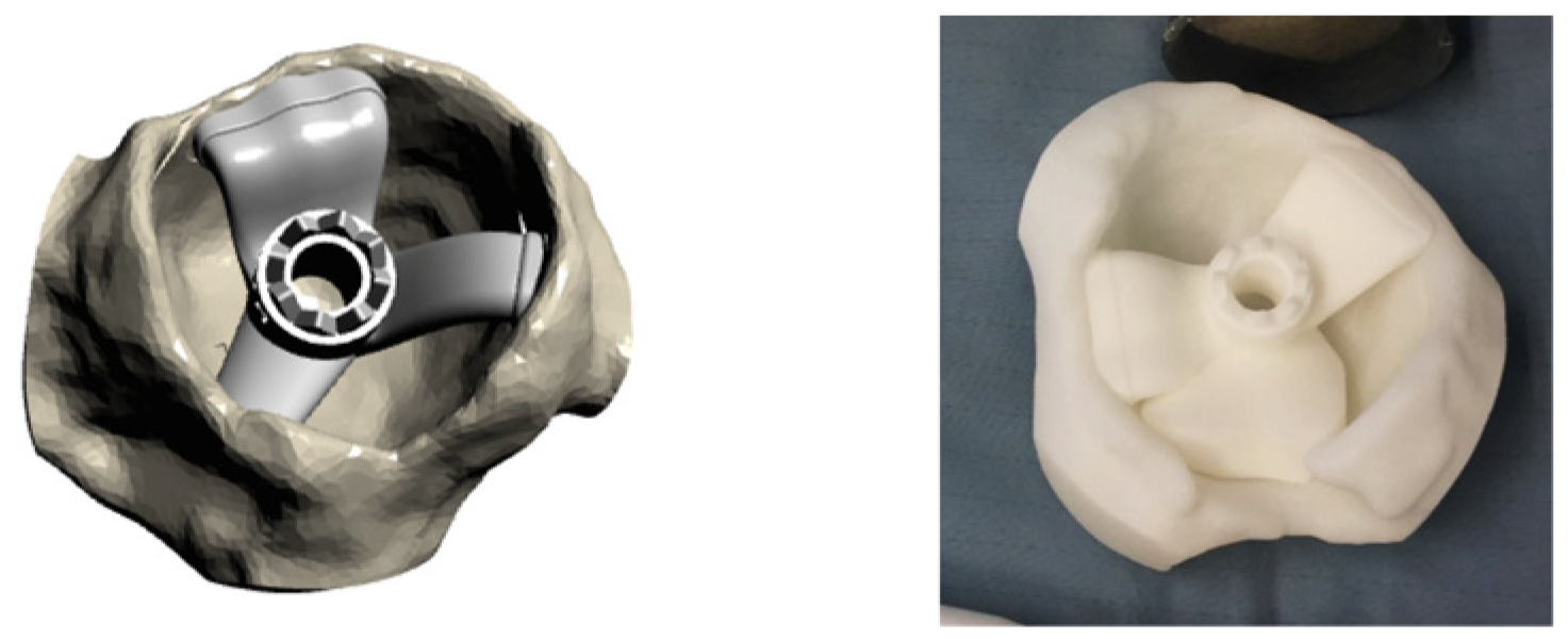 Prosthesis 05 00077 g003 Prosthesis 05 00077 g003