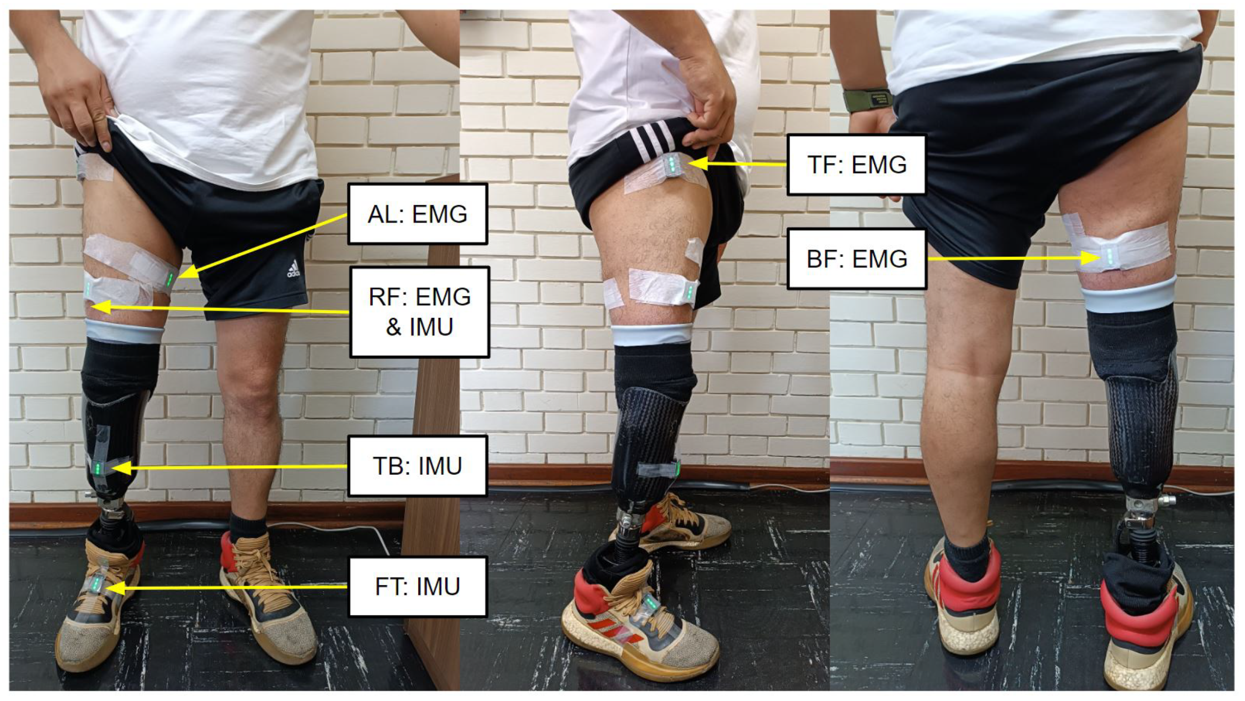 Prosthesis 05 00085 g001 Prosthesis 05 00085 g001