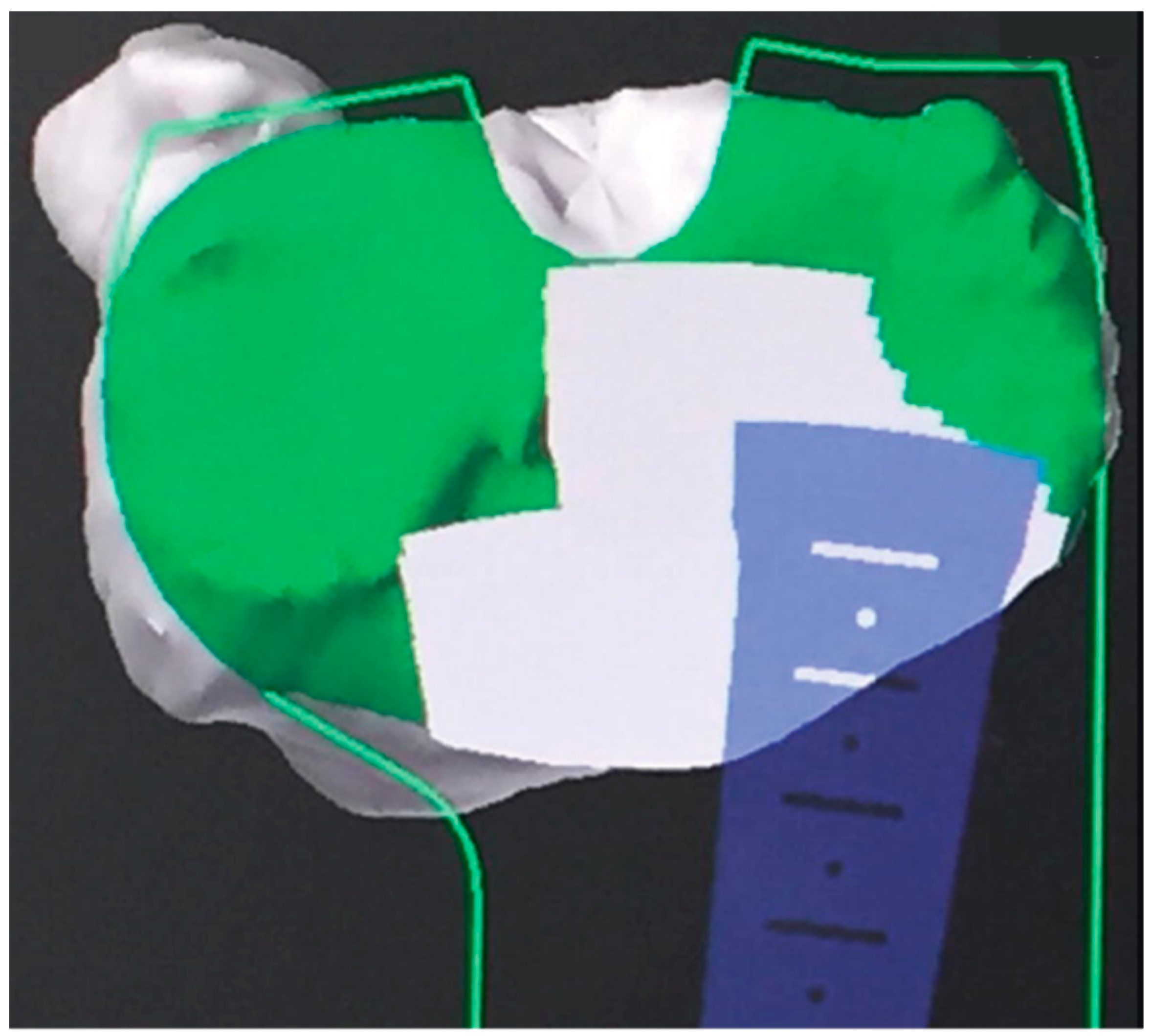 Prosthesis 05 00086 g002