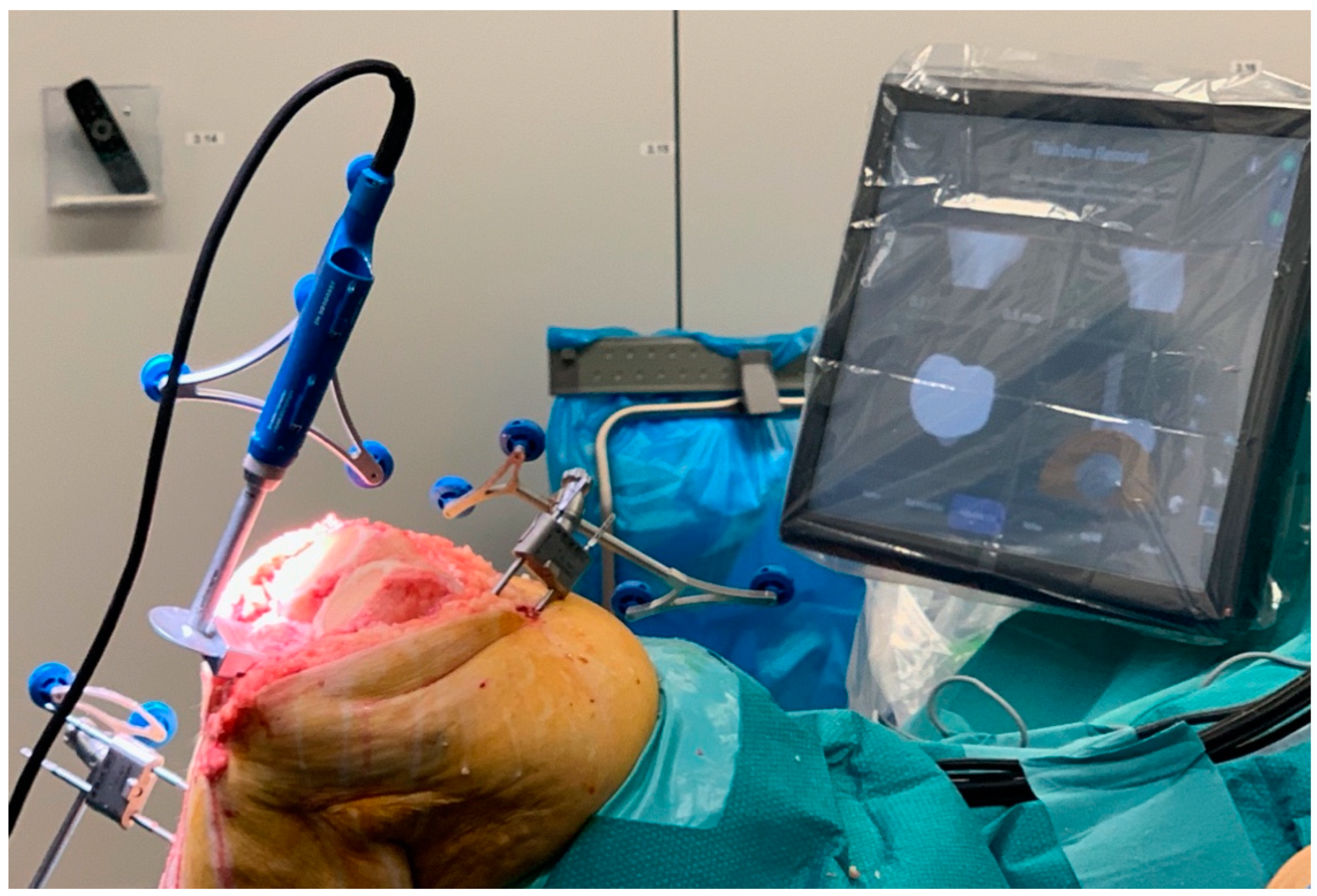 Prosthesis 05 00086 g004