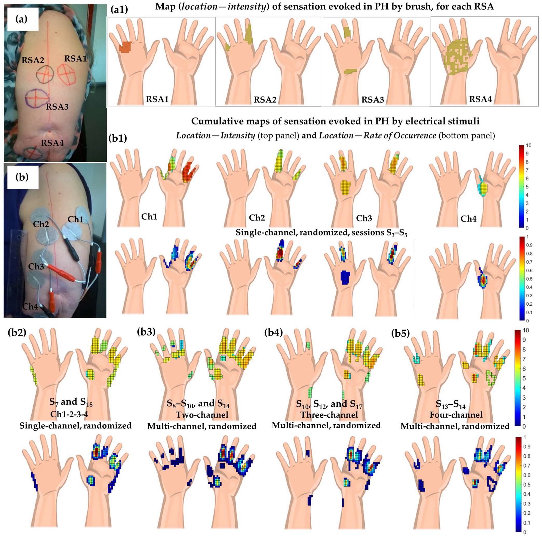 Prosthesis 06 00001 g002