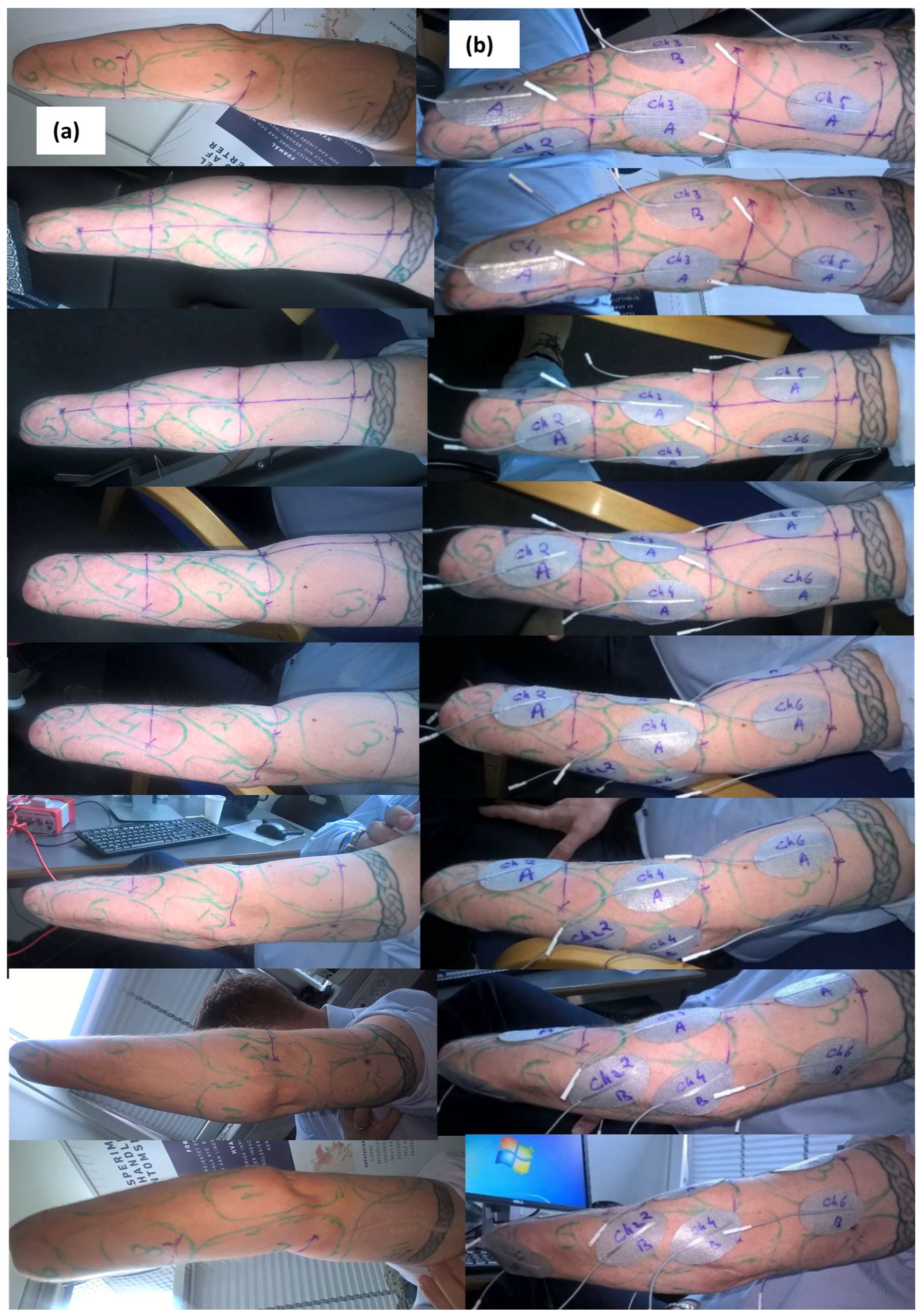 Prosthesis 06 00001 g004