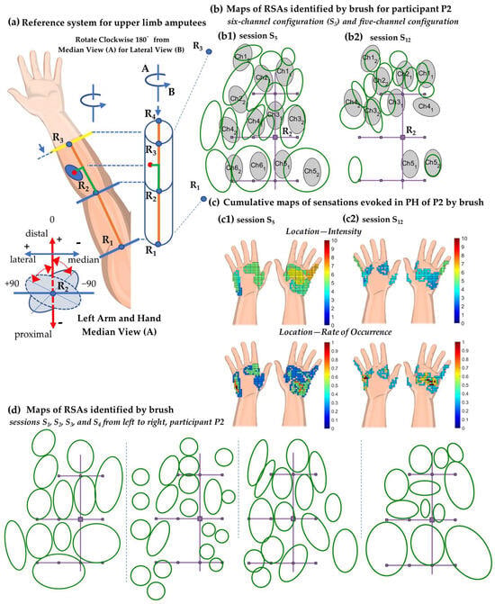 Prosthesis 06 00001 g0a1