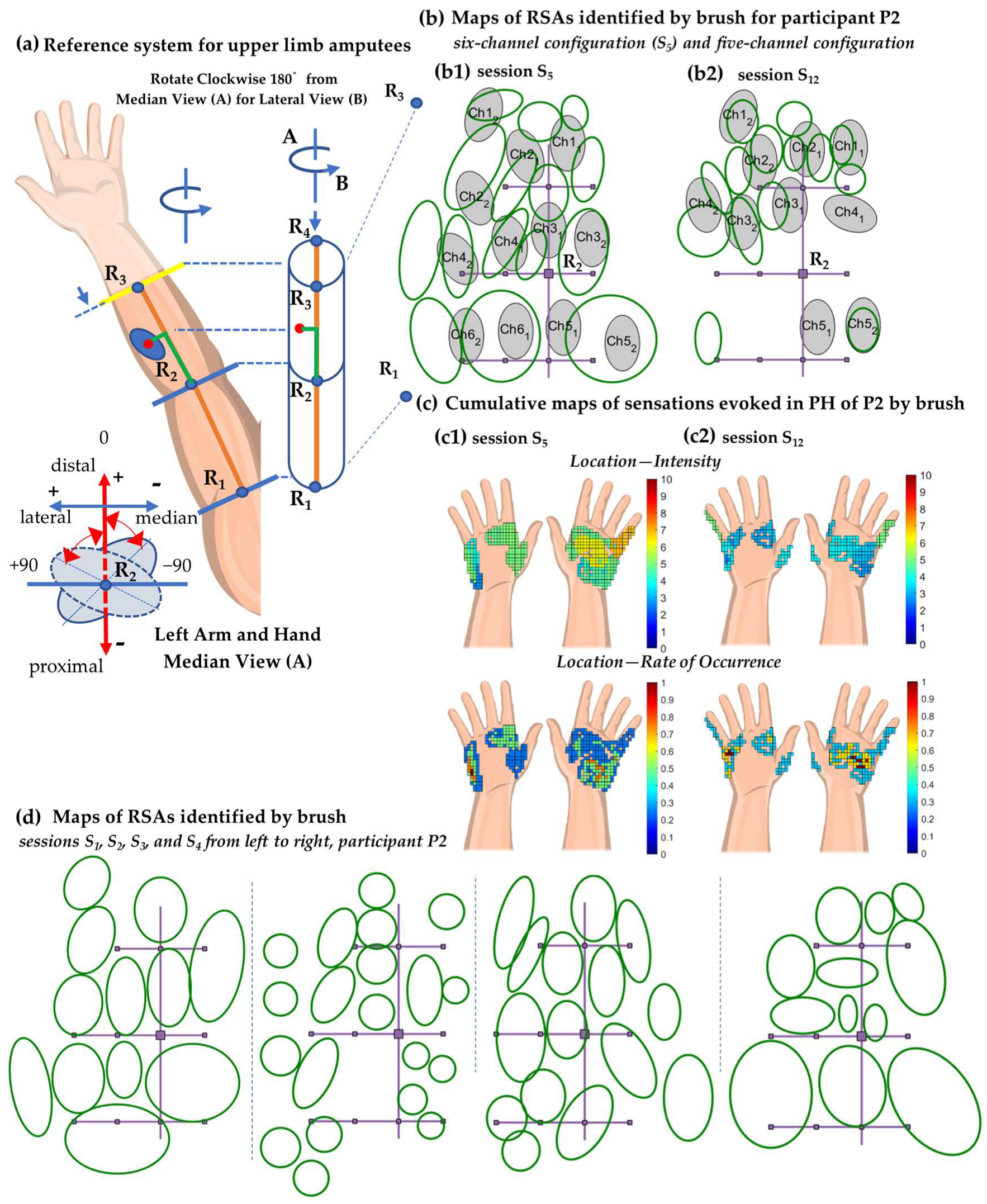 Prosthesis 06 00001 g0a1