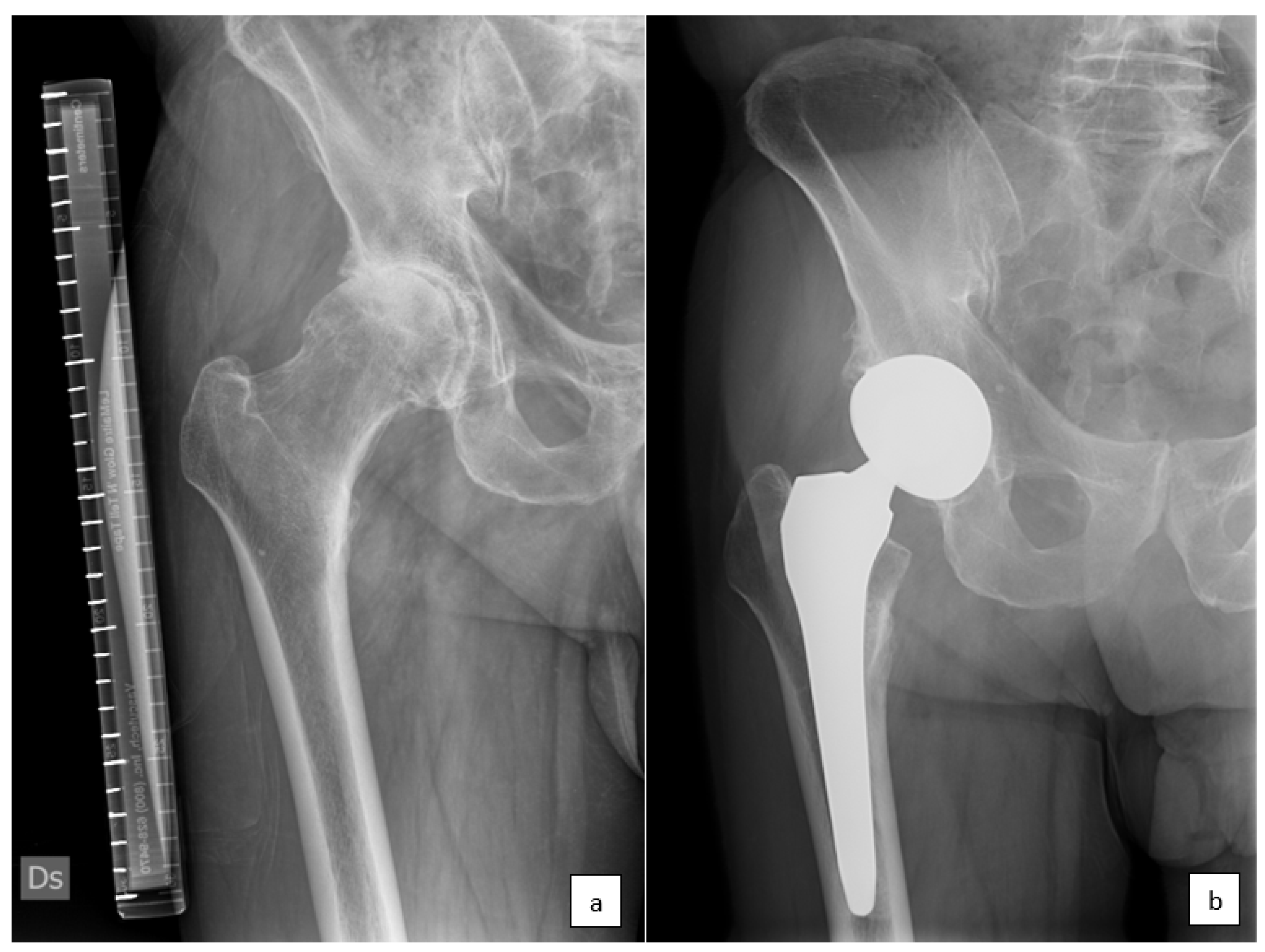 Prosthesis 06 00004 g001