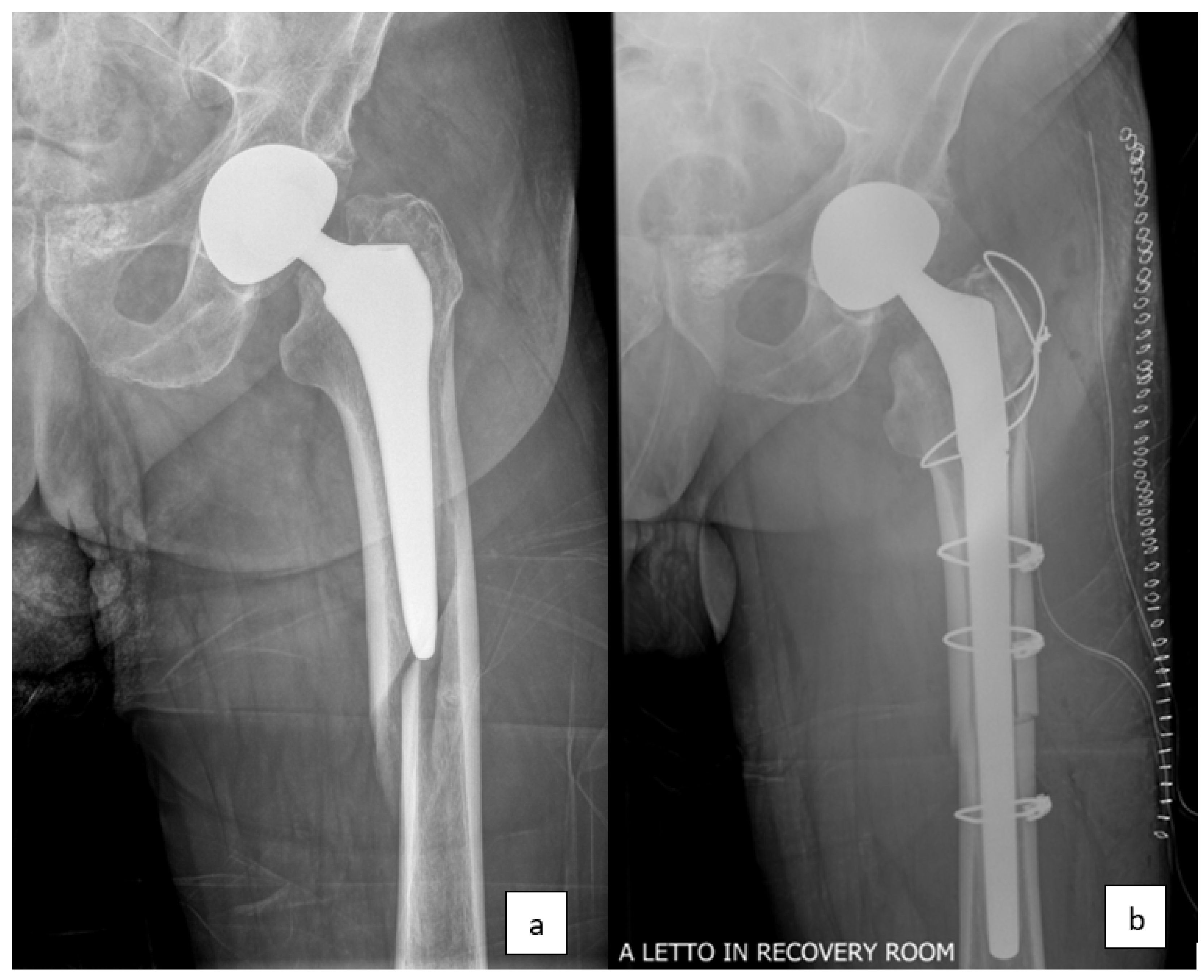 Prosthesis 06 00004 g002