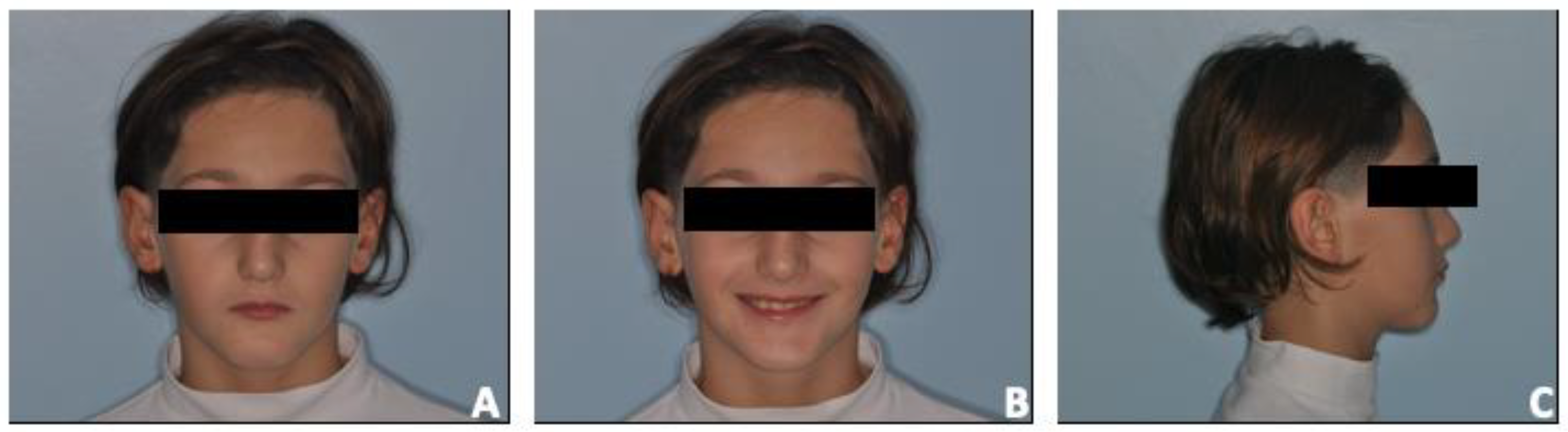 Prosthesis 06 00011 g001 Prosthesis 06 00011 g001