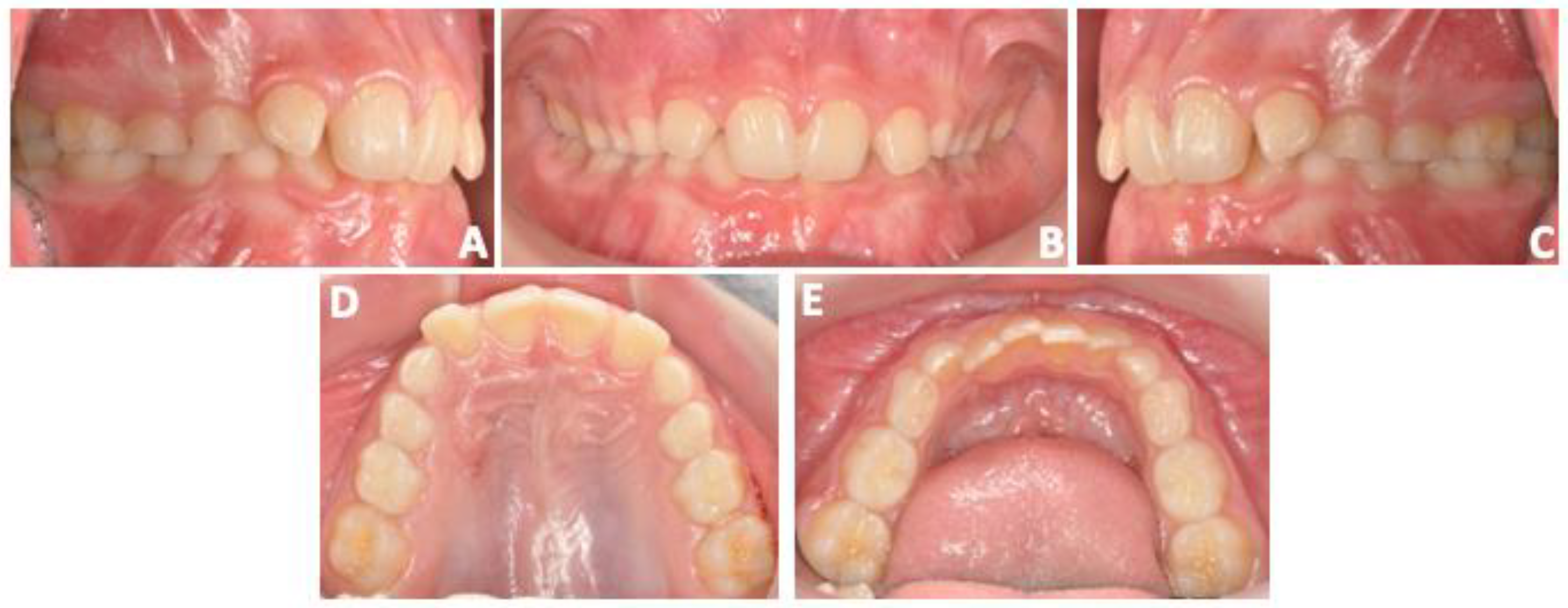 Prosthesis 06 00011 g002 Prosthesis 06 00011 g002