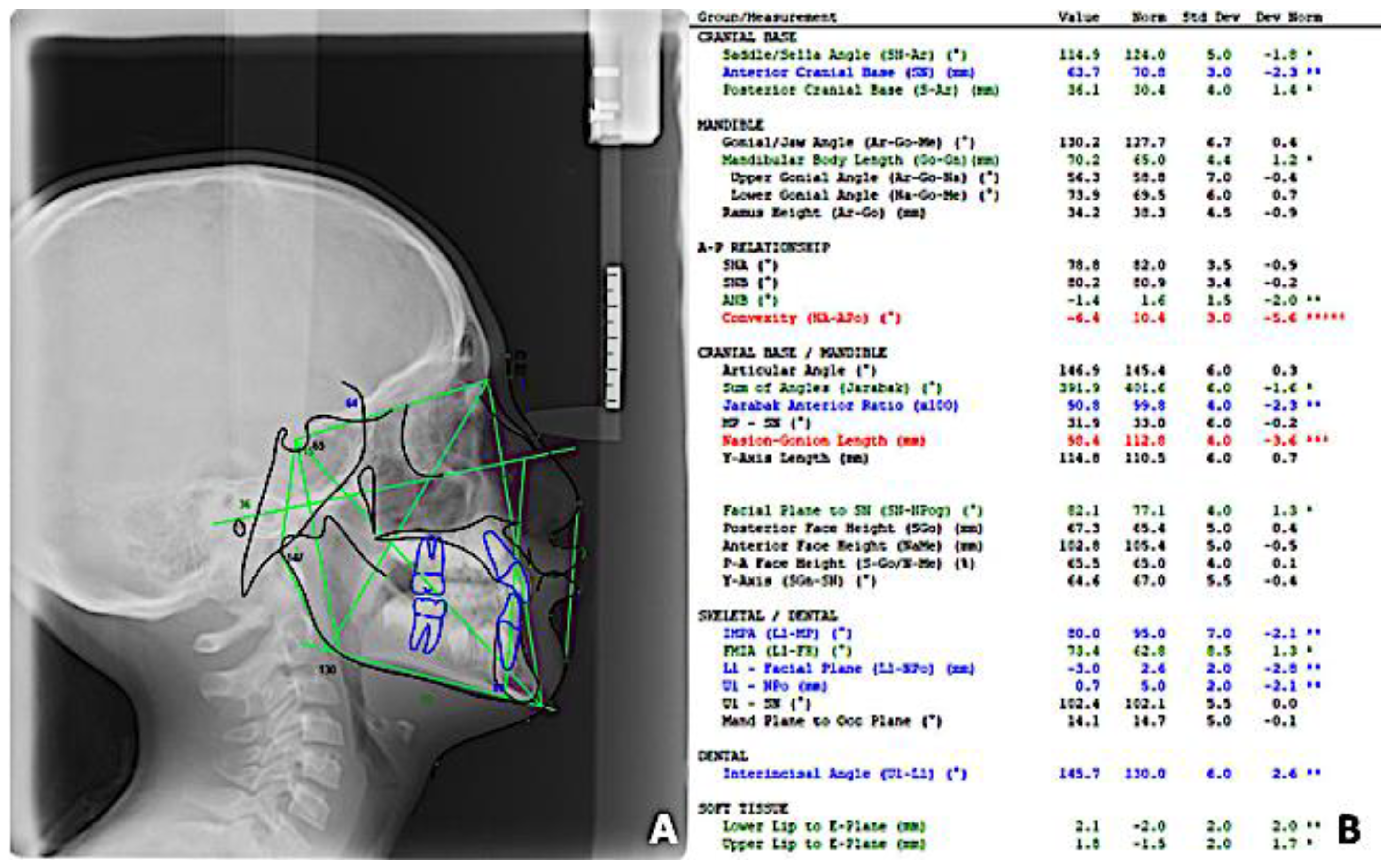 Prosthesis 06 00011 g003 Prosthesis 06 00011 g003