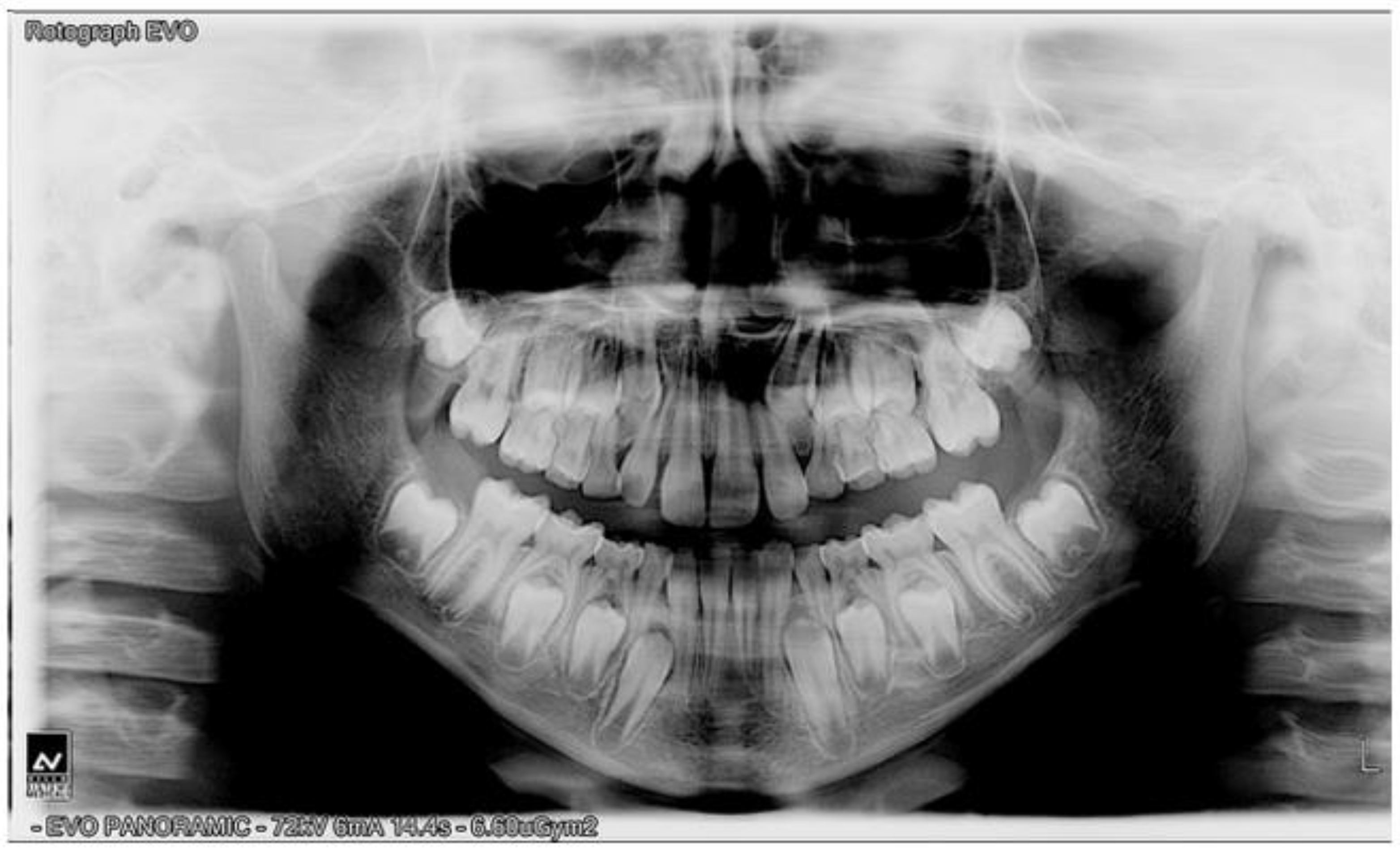 Prosthesis 06 00011 g004 Prosthesis 06 00011 g004