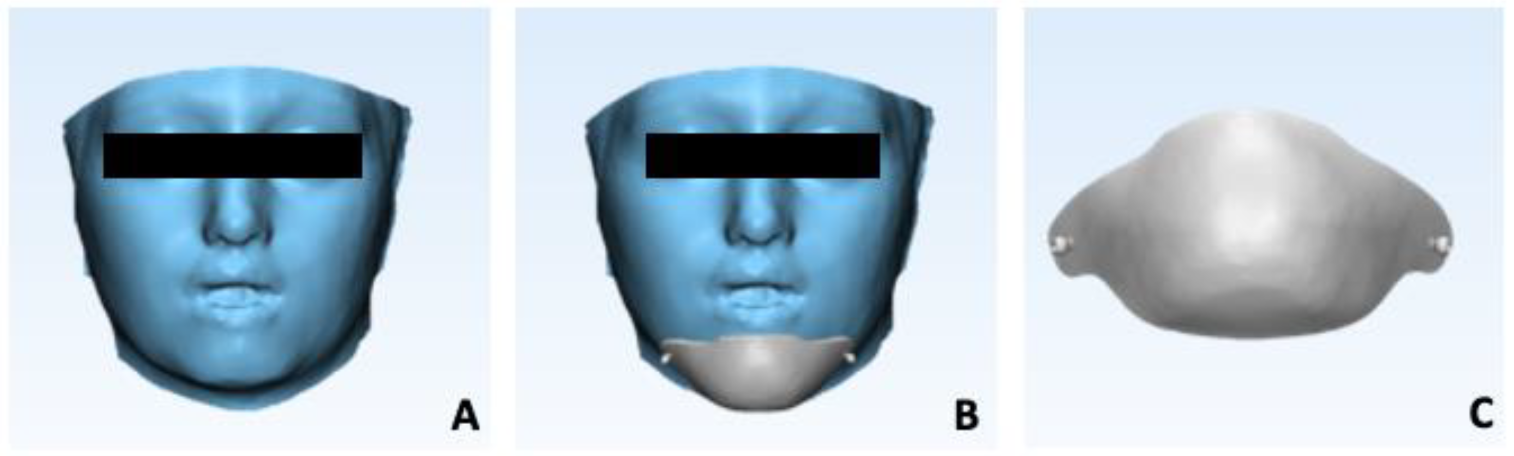 Prosthesis 06 00011 g006 Prosthesis 06 00011 g006