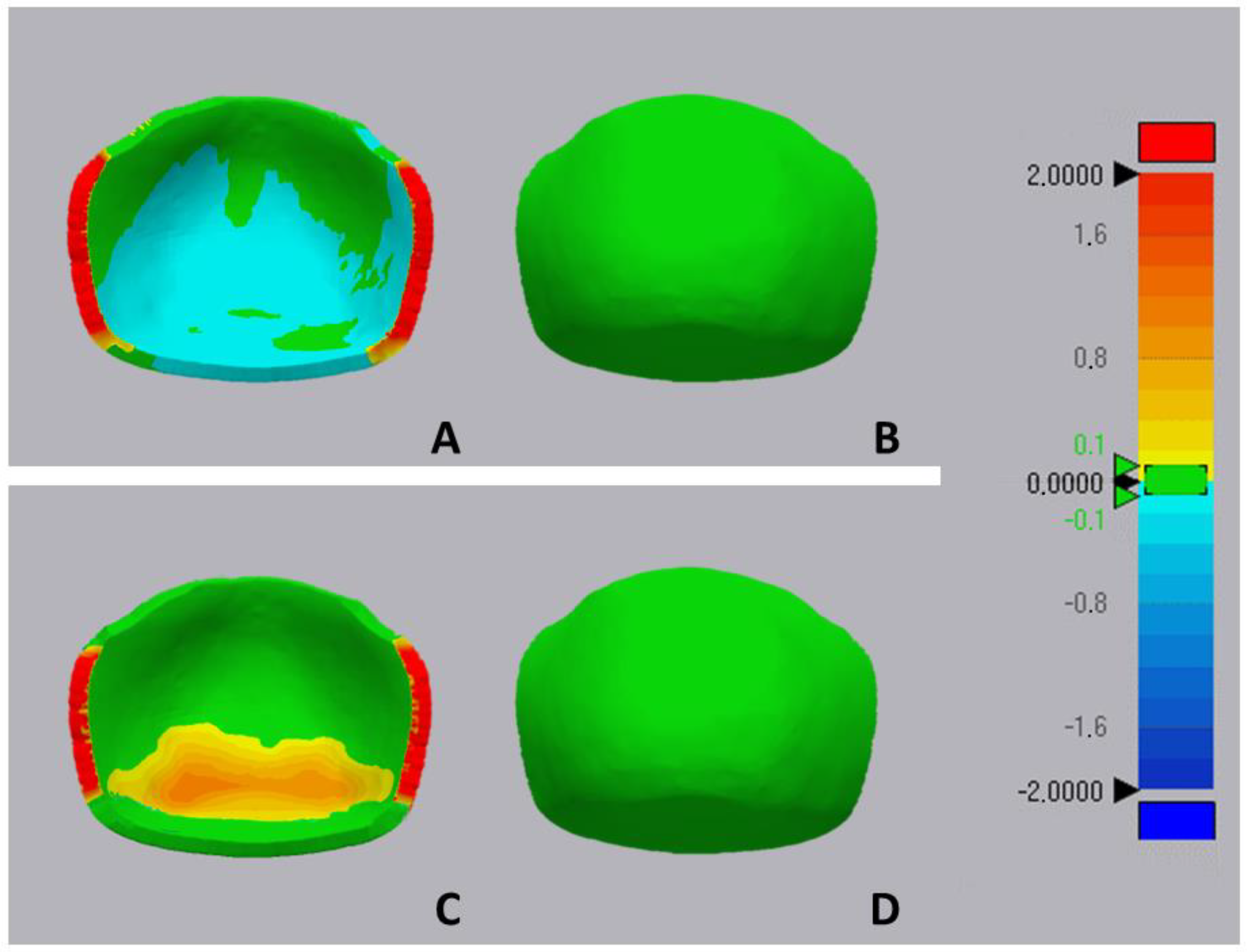 Prosthesis 06 00011 g007 Prosthesis 06 00011 g007