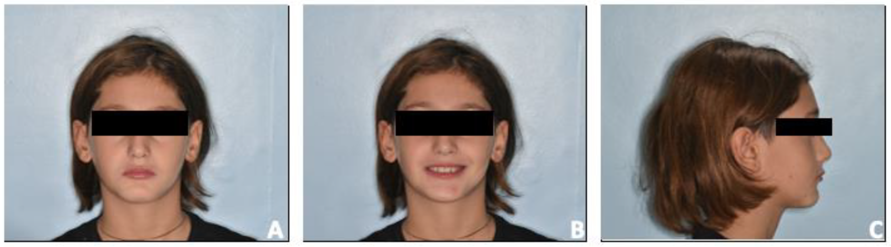 Prosthesis 06 00011 g008 Prosthesis 06 00011 g008