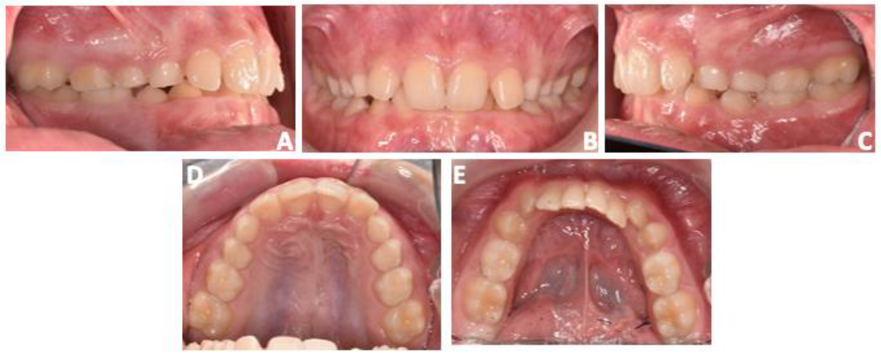 Prosthesis 06 00011 g009 Prosthesis 06 00011 g009