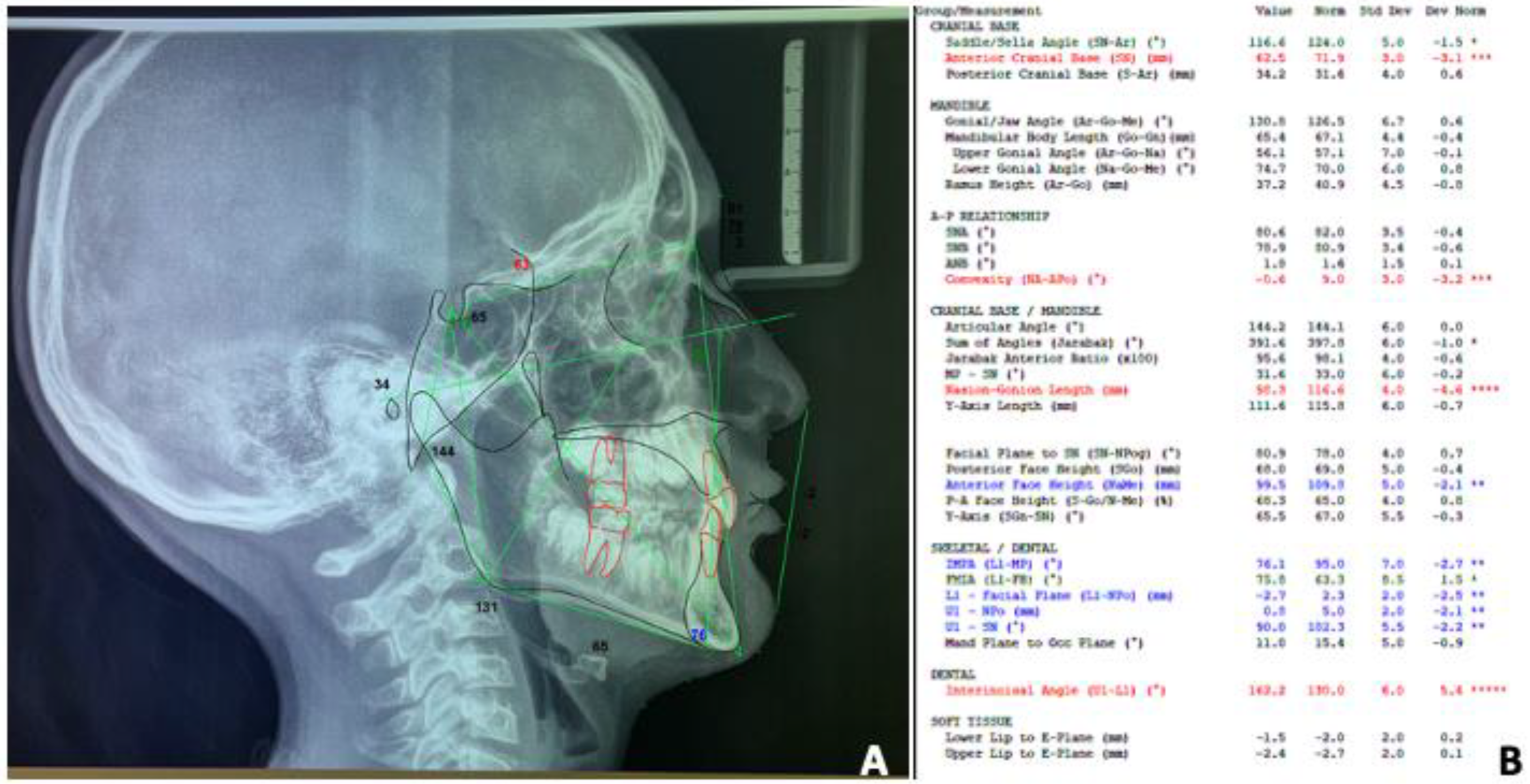 Prosthesis 06 00011 g010 Prosthesis 06 00011 g010