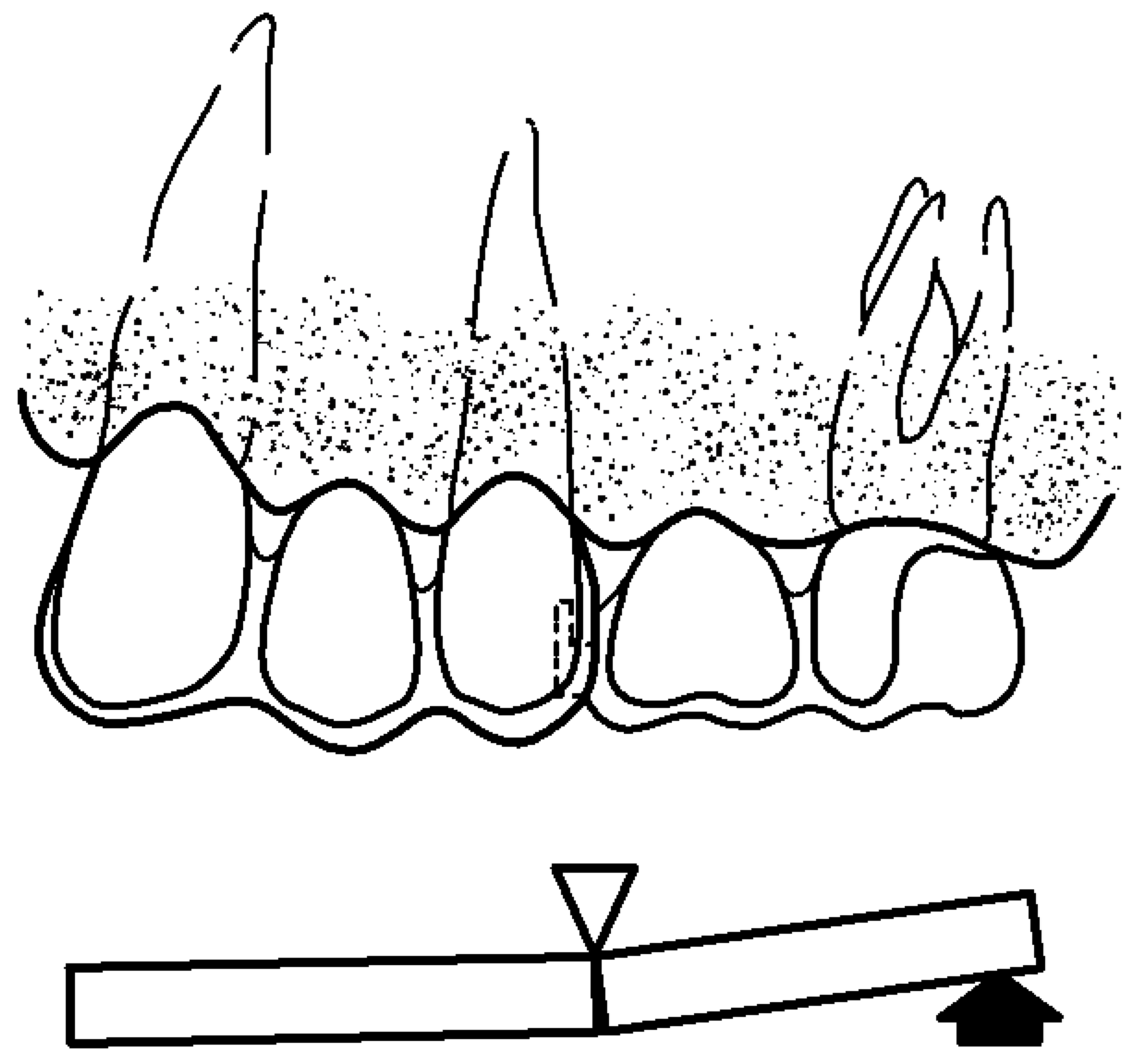 Prosthesis 06 00017 g003 Prosthesis 06 00017 g003