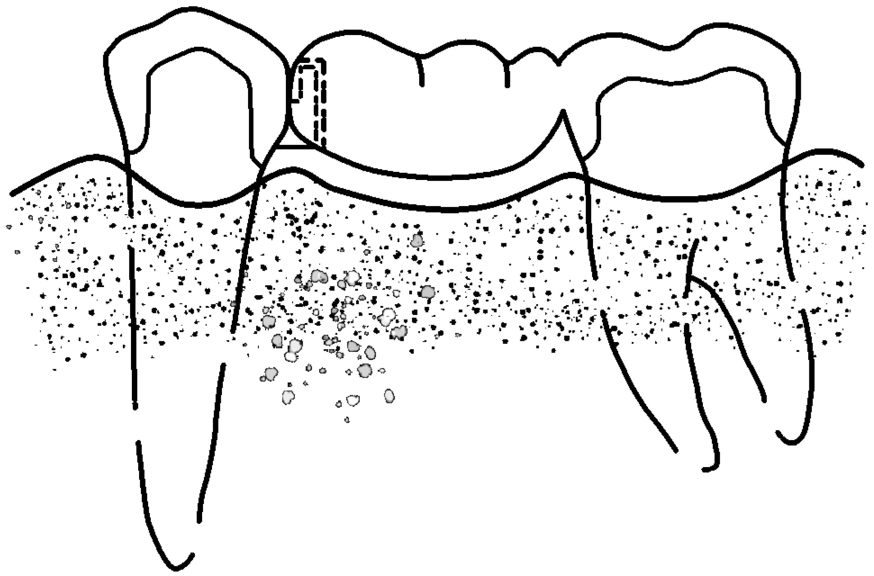 Prosthesis 06 00017 g004 Prosthesis 06 00017 g004