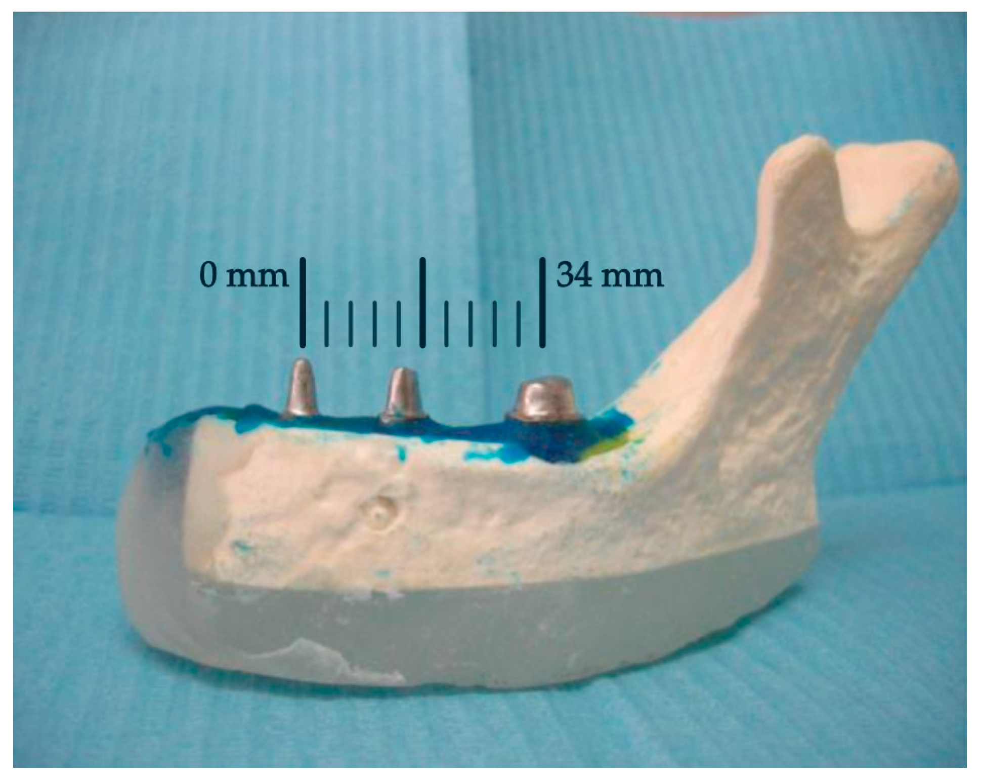 Prosthesis 06 00017 g005 Prosthesis 06 00017 g005