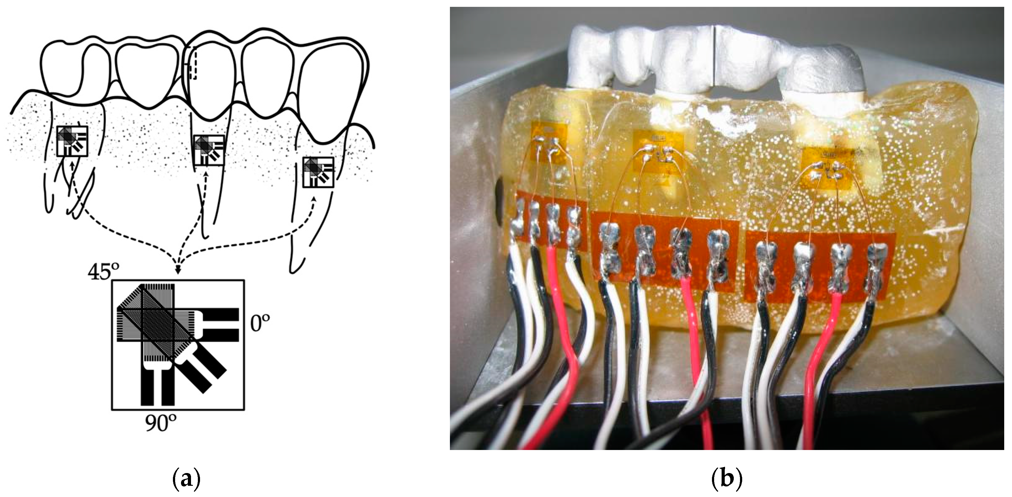 Prosthesis 06 00017 g009 Prosthesis 06 00017 g009