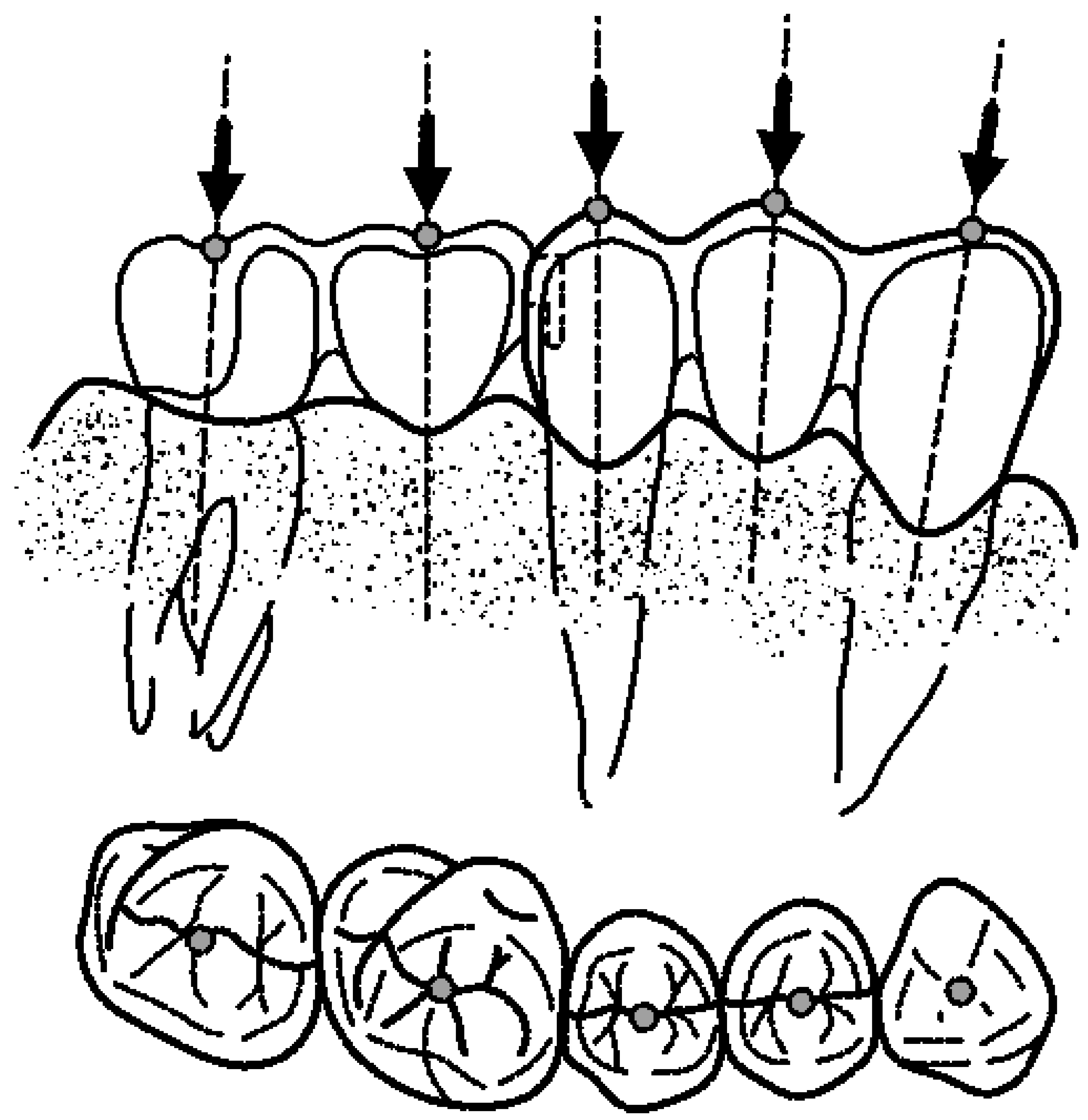 Prosthesis 06 00017 g010 Prosthesis 06 00017 g010