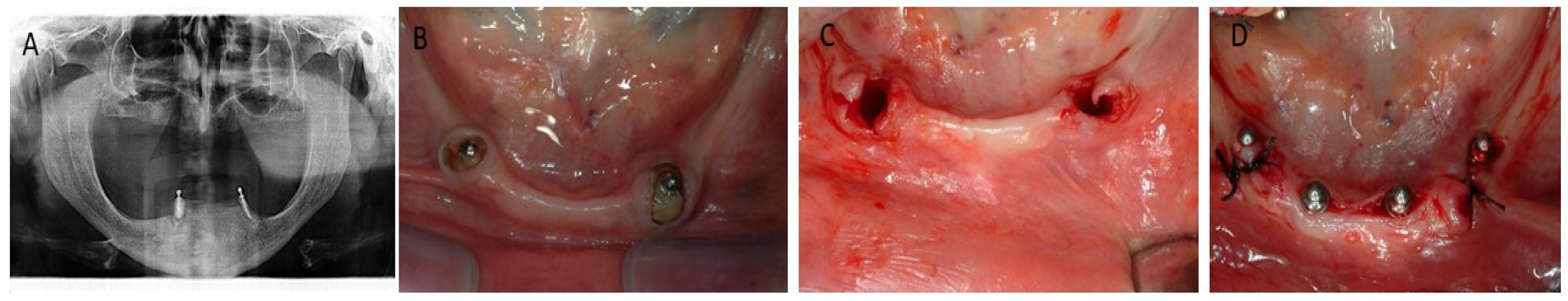 Prosthesis 06 00019 g001