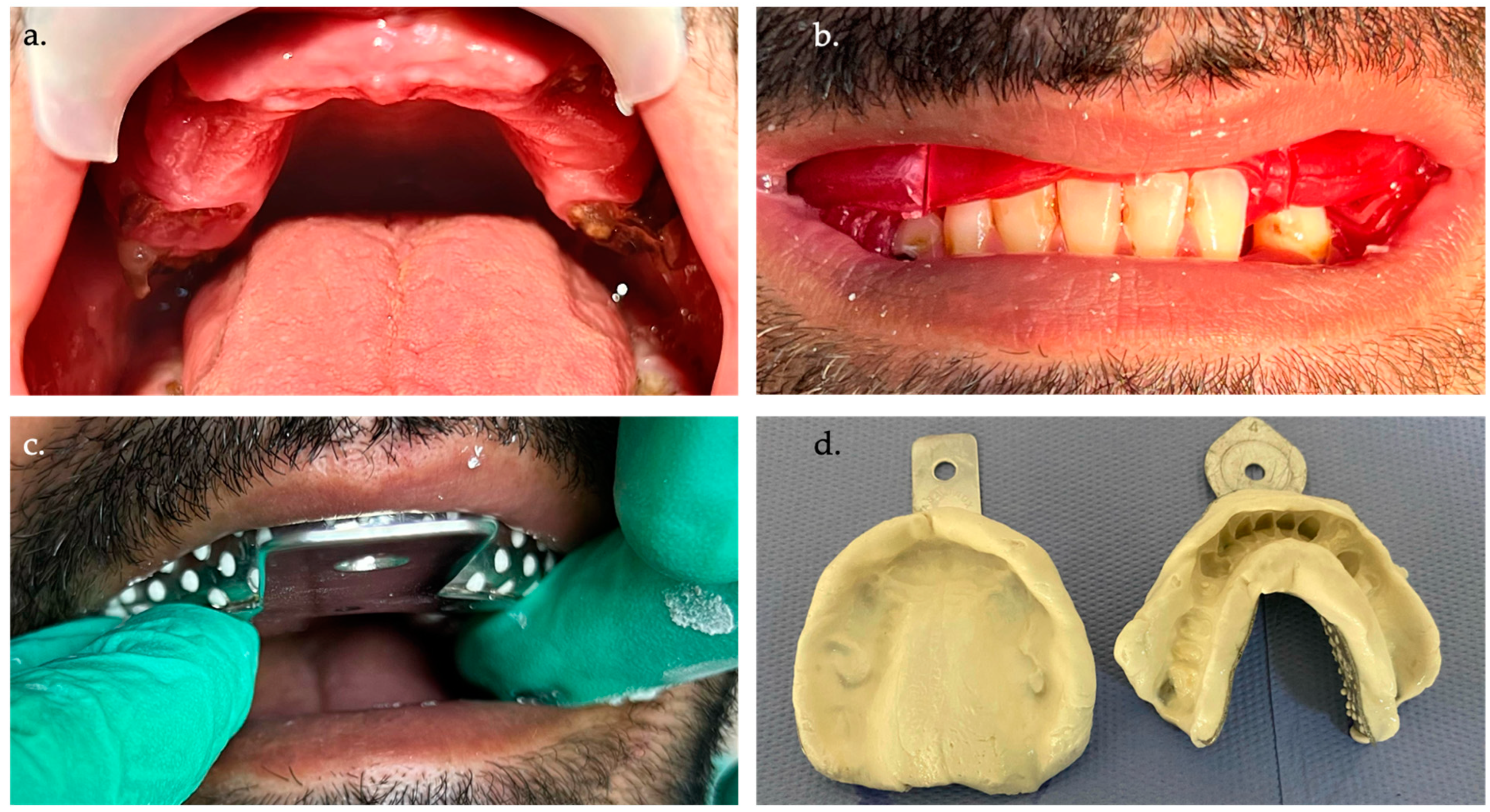 Prosthesis 06 00037 g001