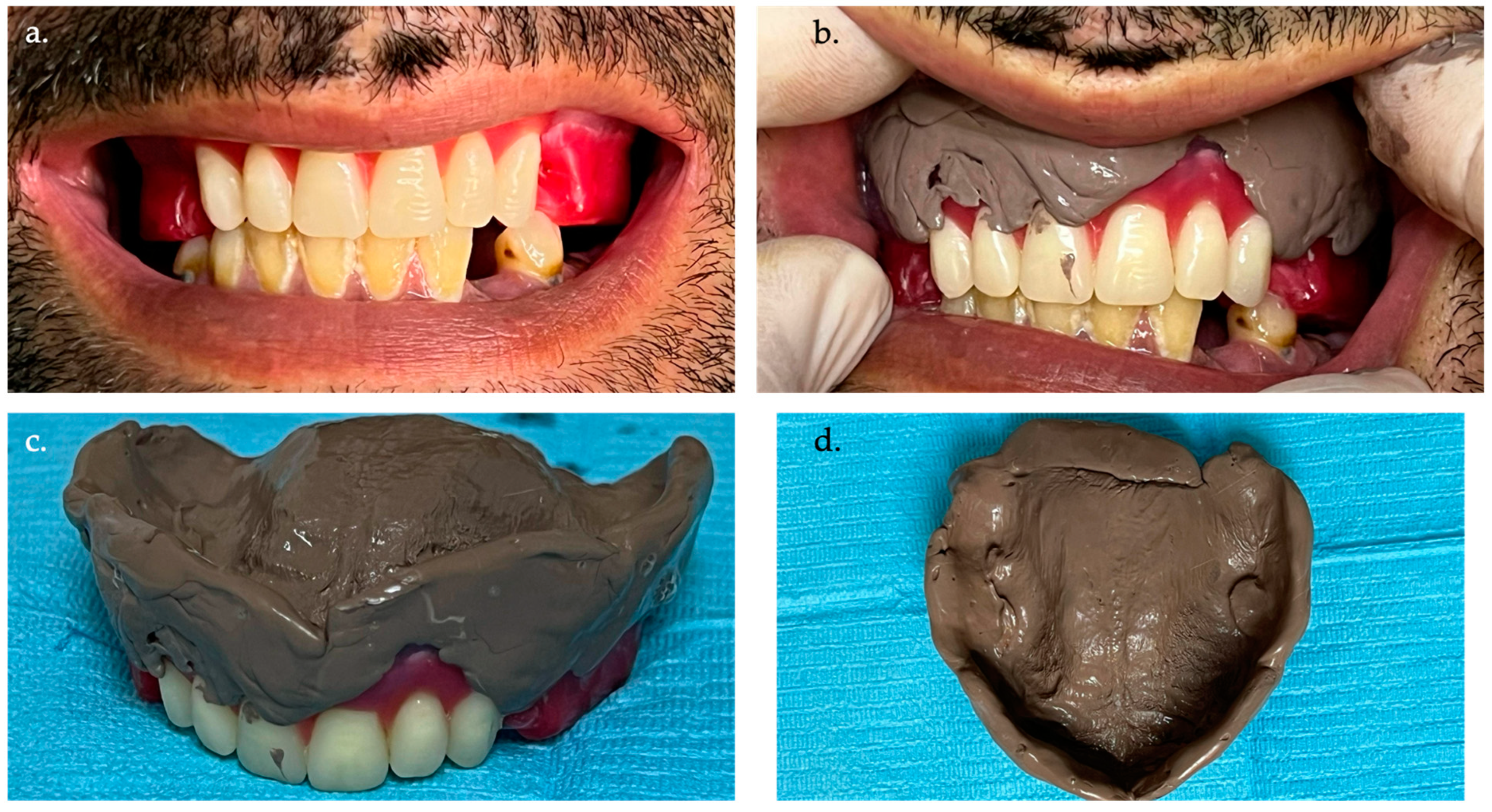 Prosthesis 06 00037 g003