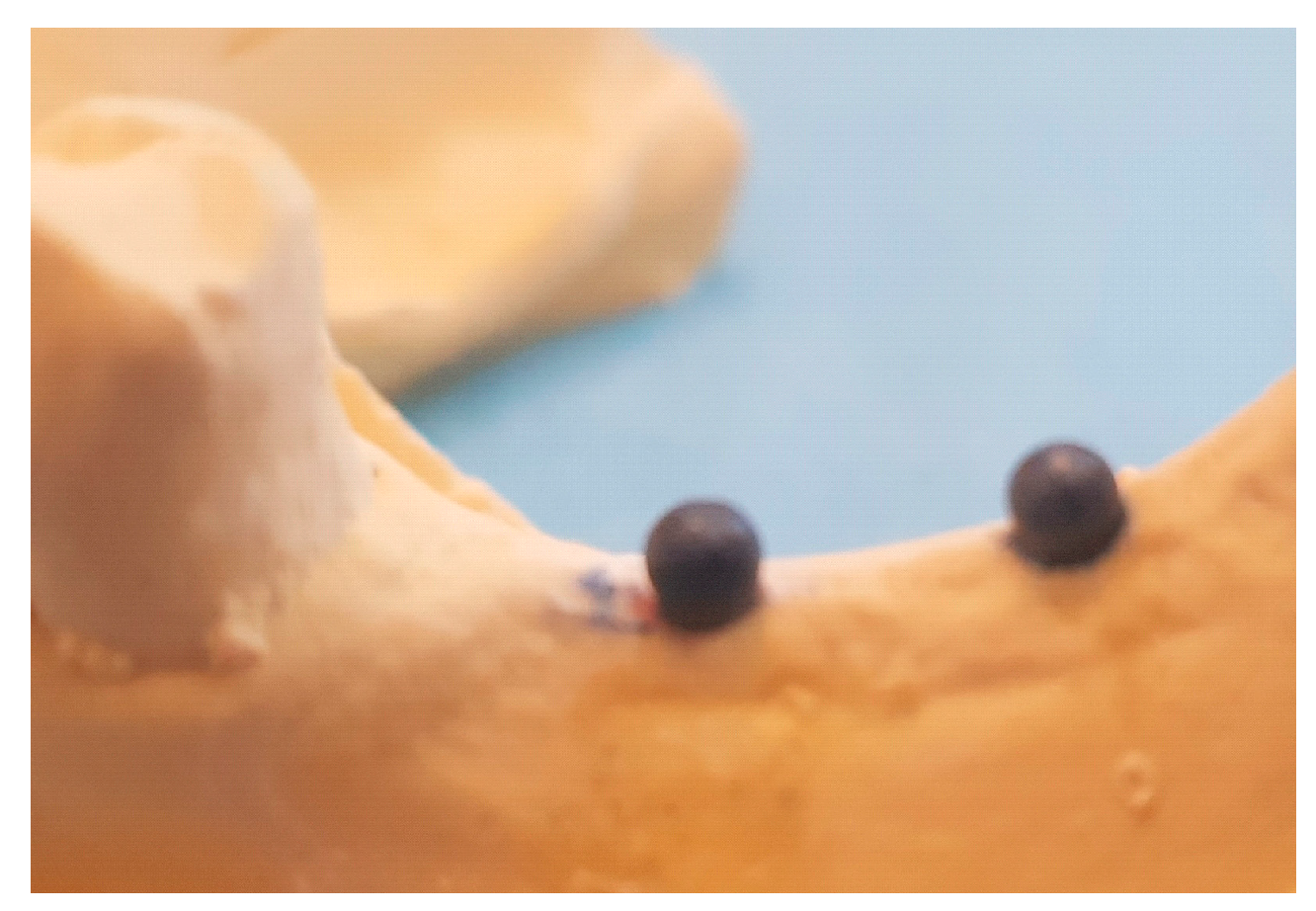Prosthesis 06 00039 g001 Prosthesis 06 00039 g001