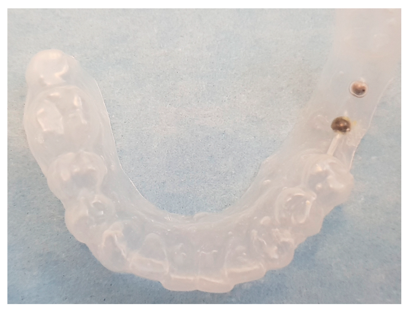 Prosthesis 06 00039 g002 Prosthesis 06 00039 g002