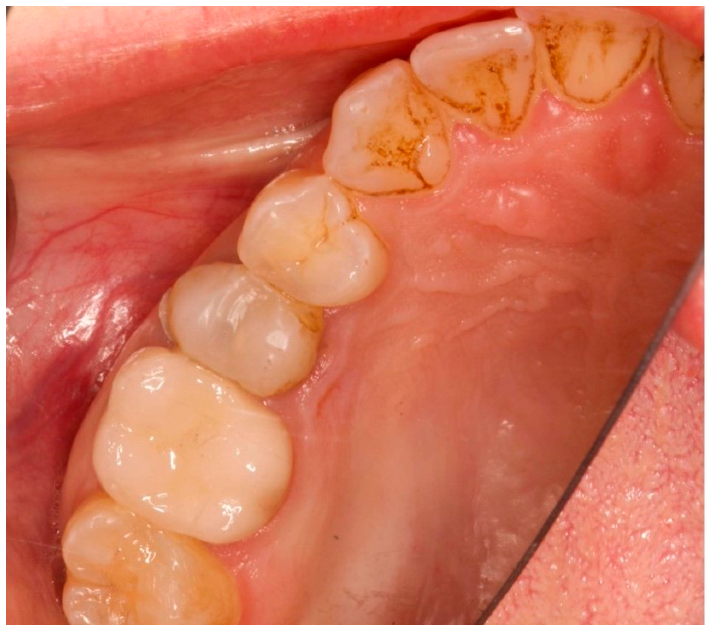 Prosthesis 06 00042 g002