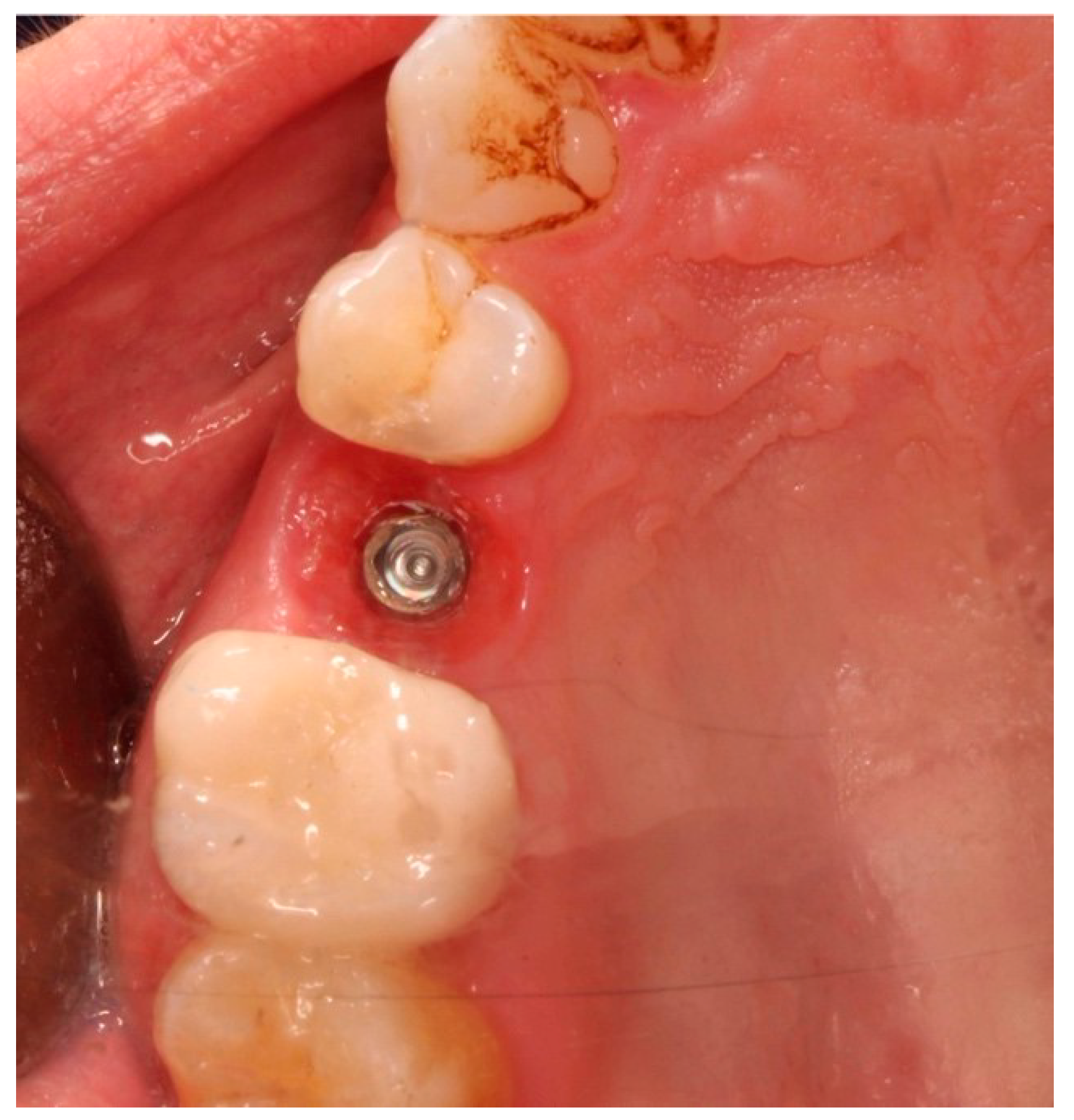 Prosthesis 06 00042 g007