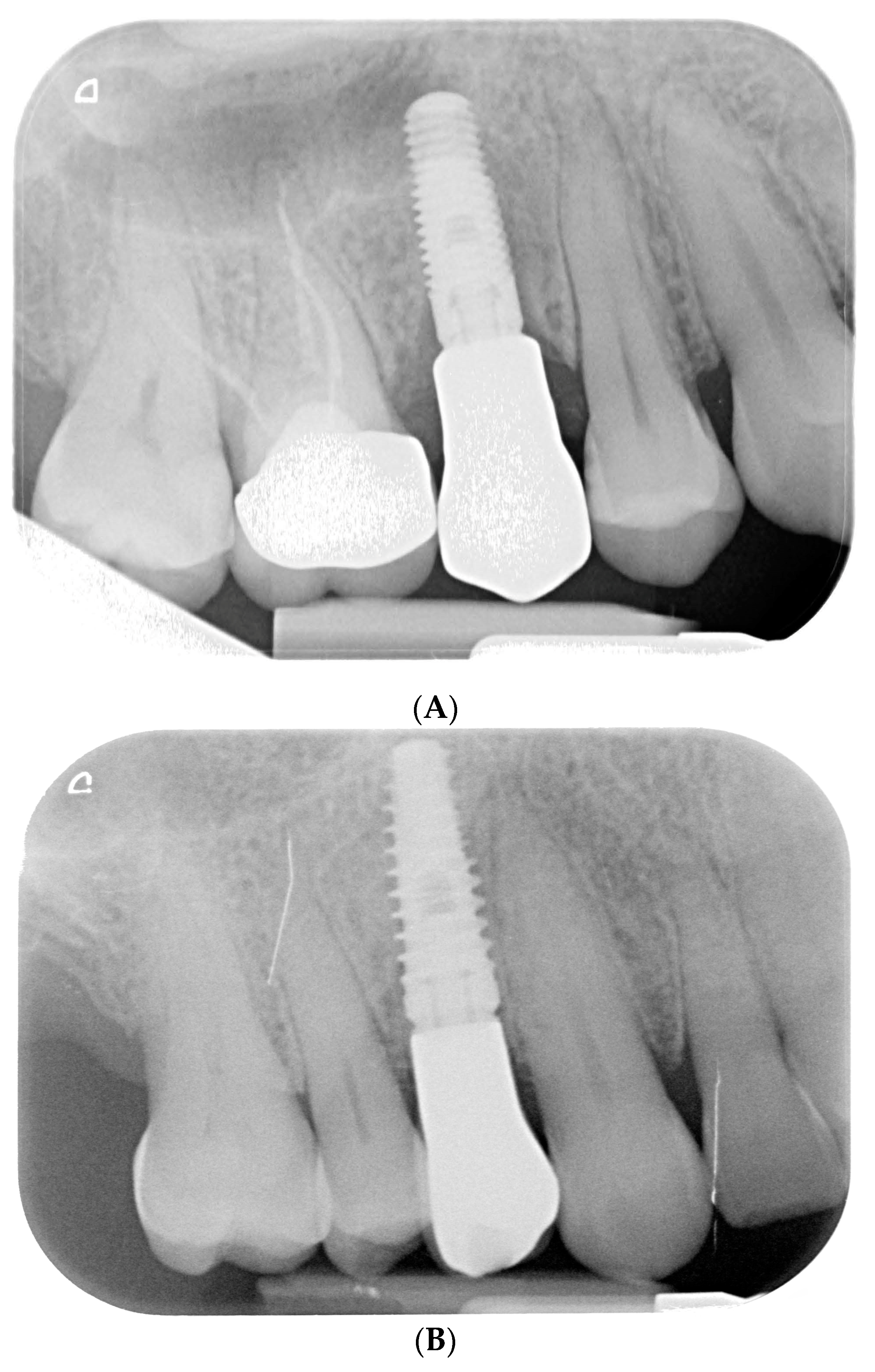 Prosthesis 06 00042 g009