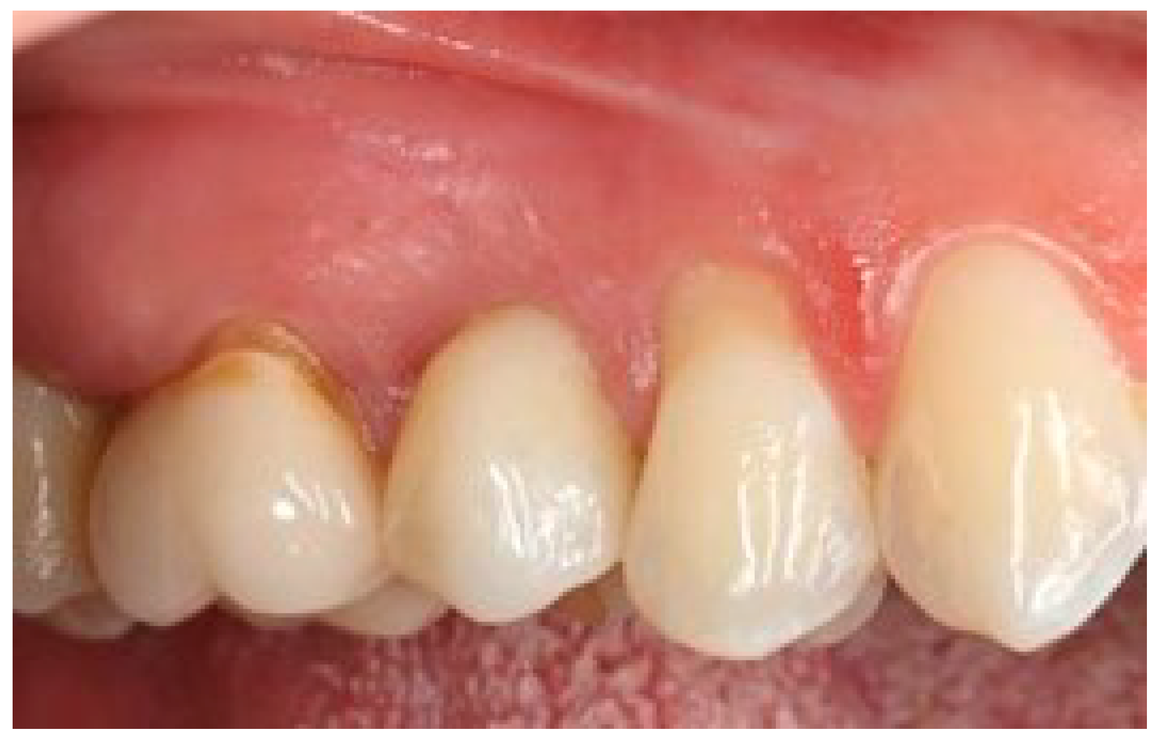 Prosthesis 06 00042 g016