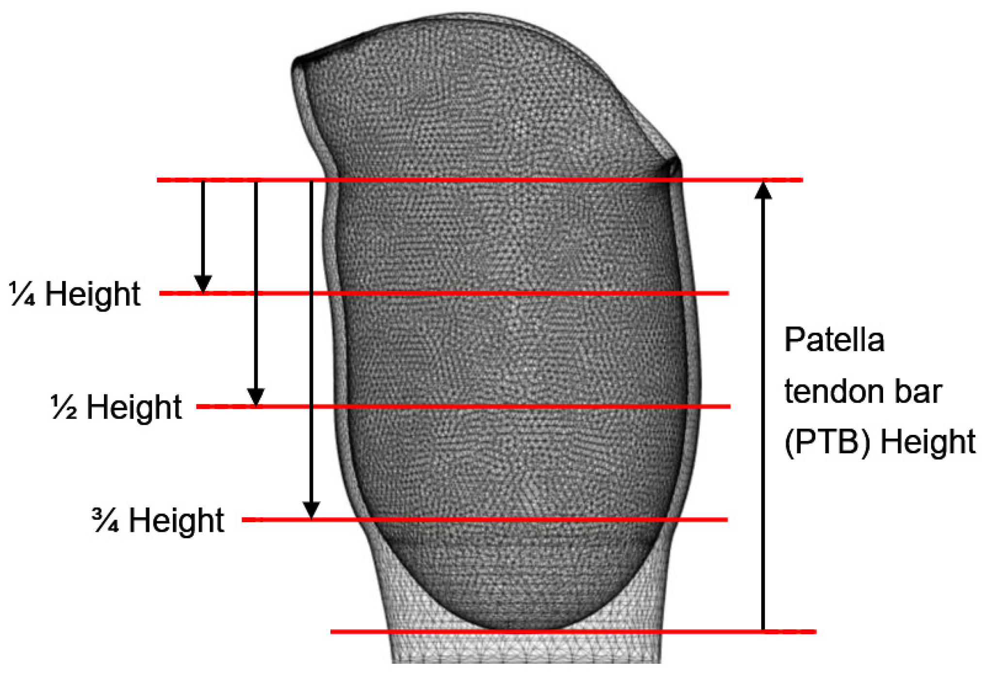 Prosthesis 06 00048 g003 Prosthesis 06 00048 g003