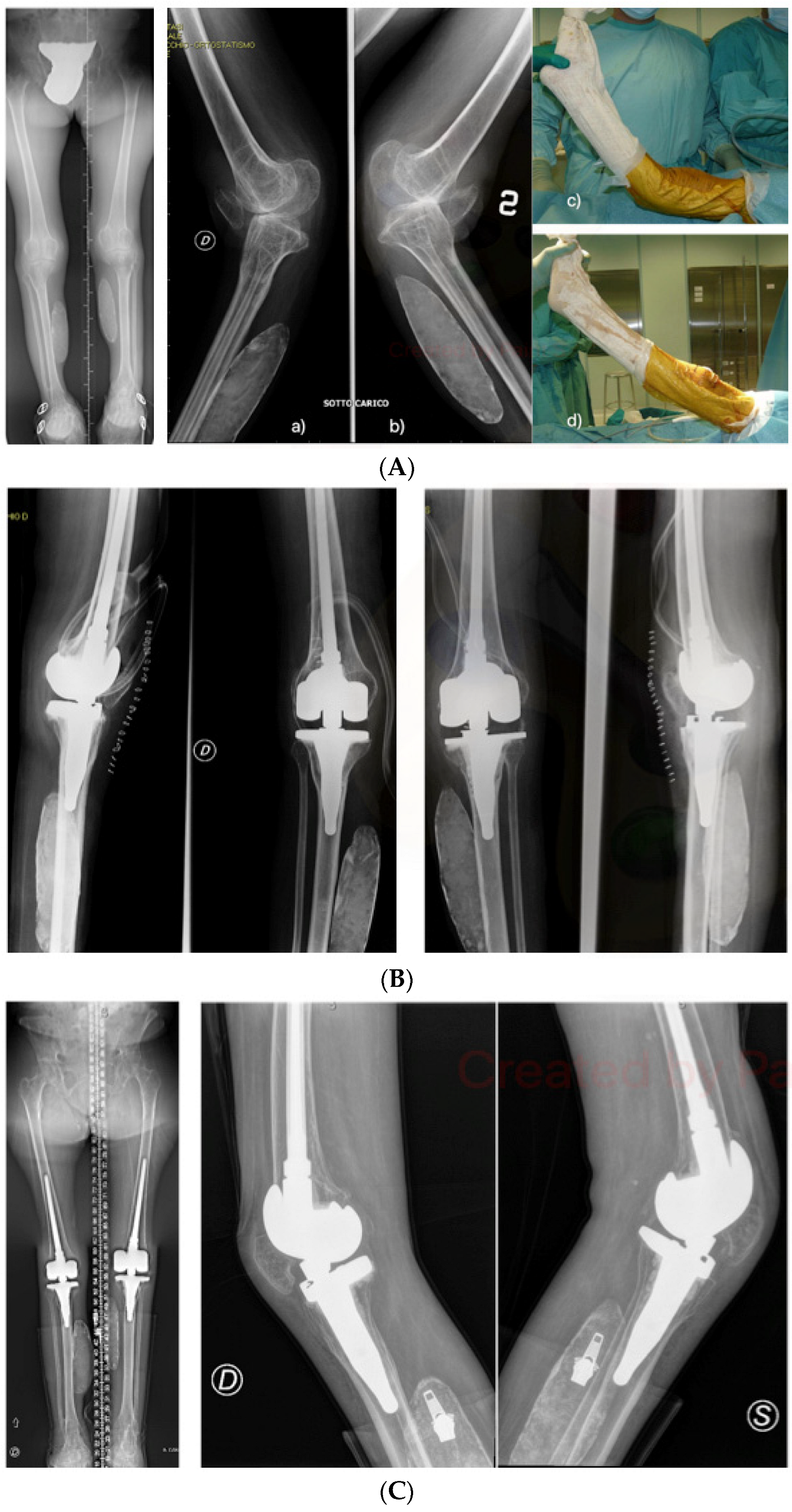 Prosthesis 06 00061 g003