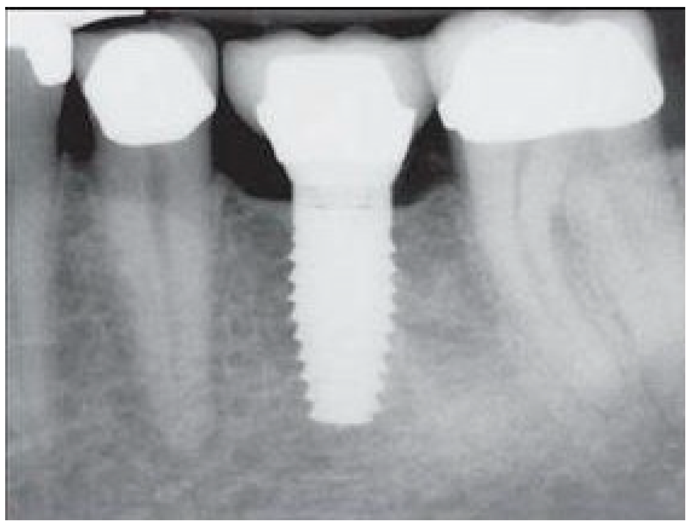 Prosthesis 06 00065 g001