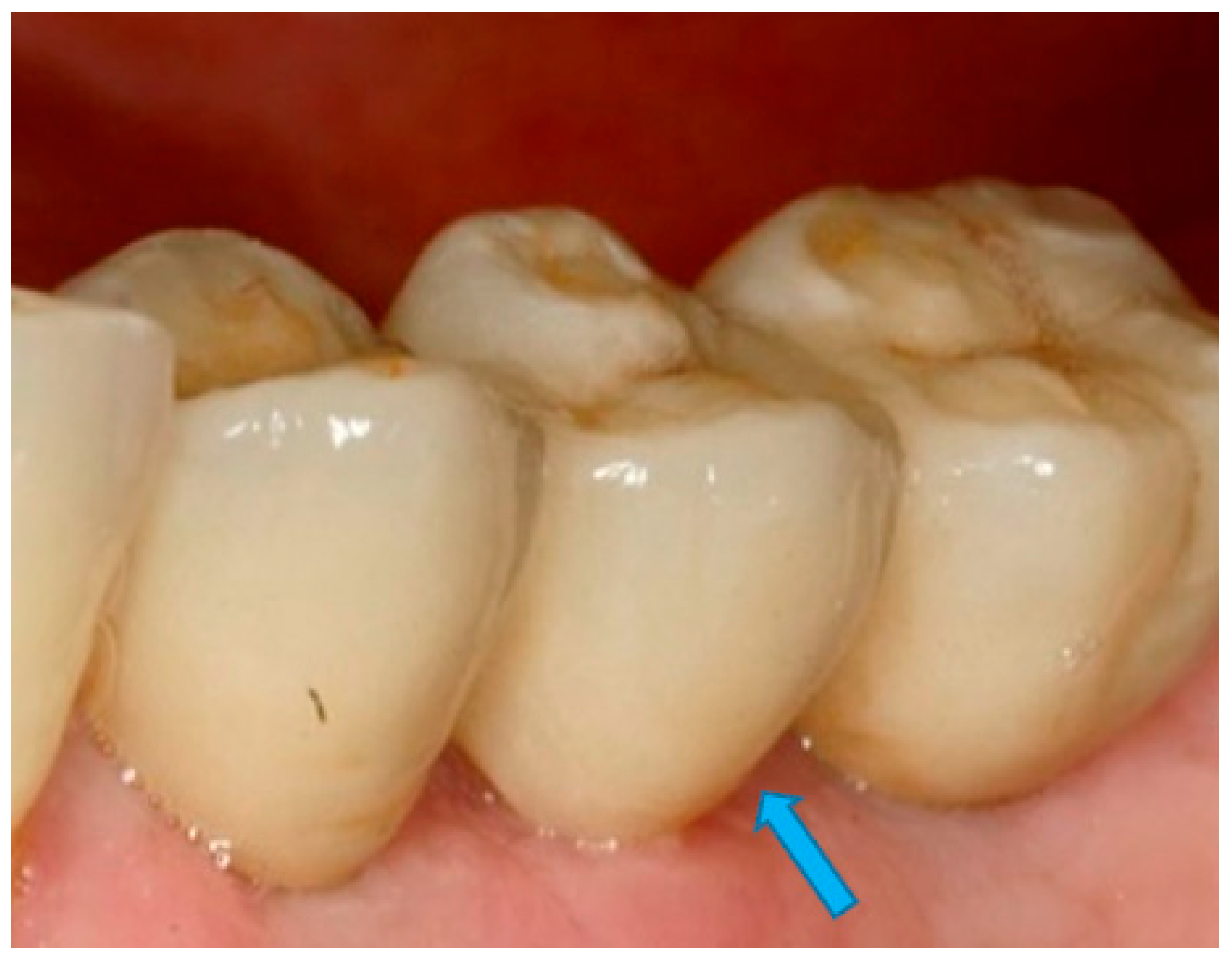 Prosthesis 06 00065 g002