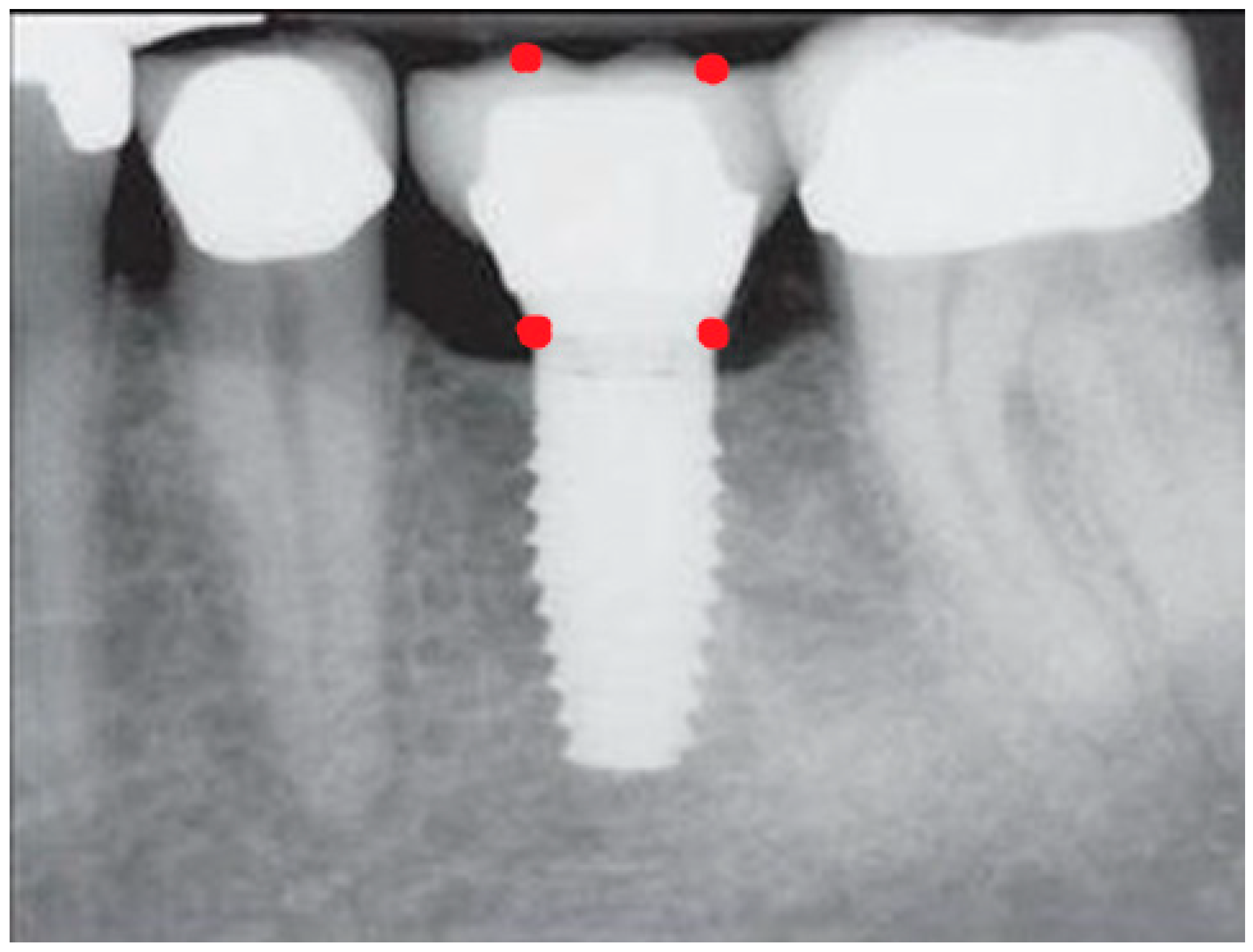 Prosthesis 06 00065 g003