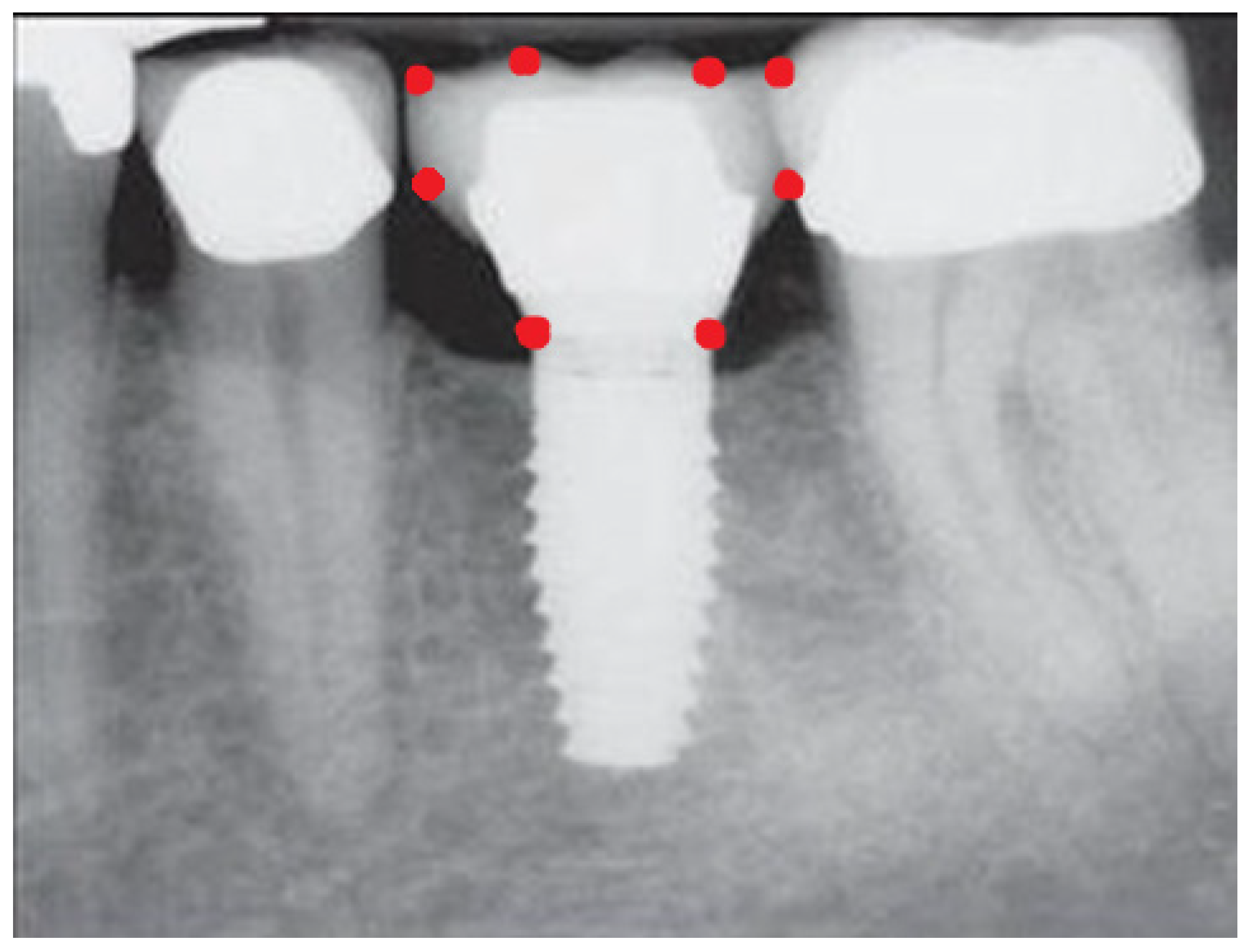 Prosthesis 06 00065 g004