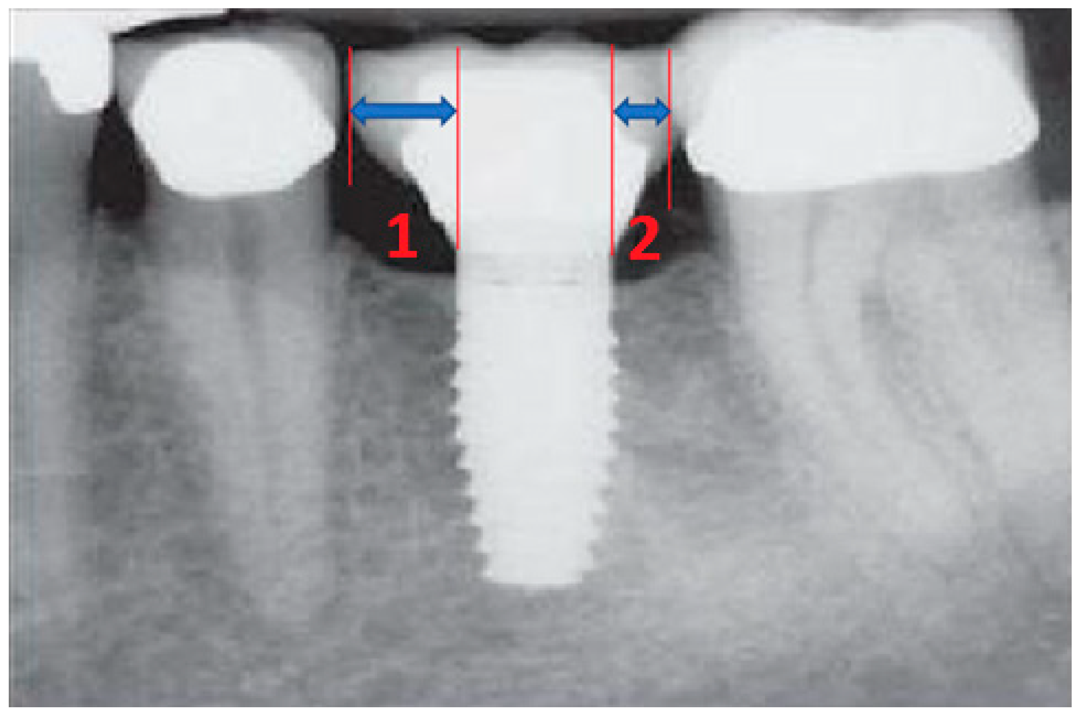 Prosthesis 06 00065 g006