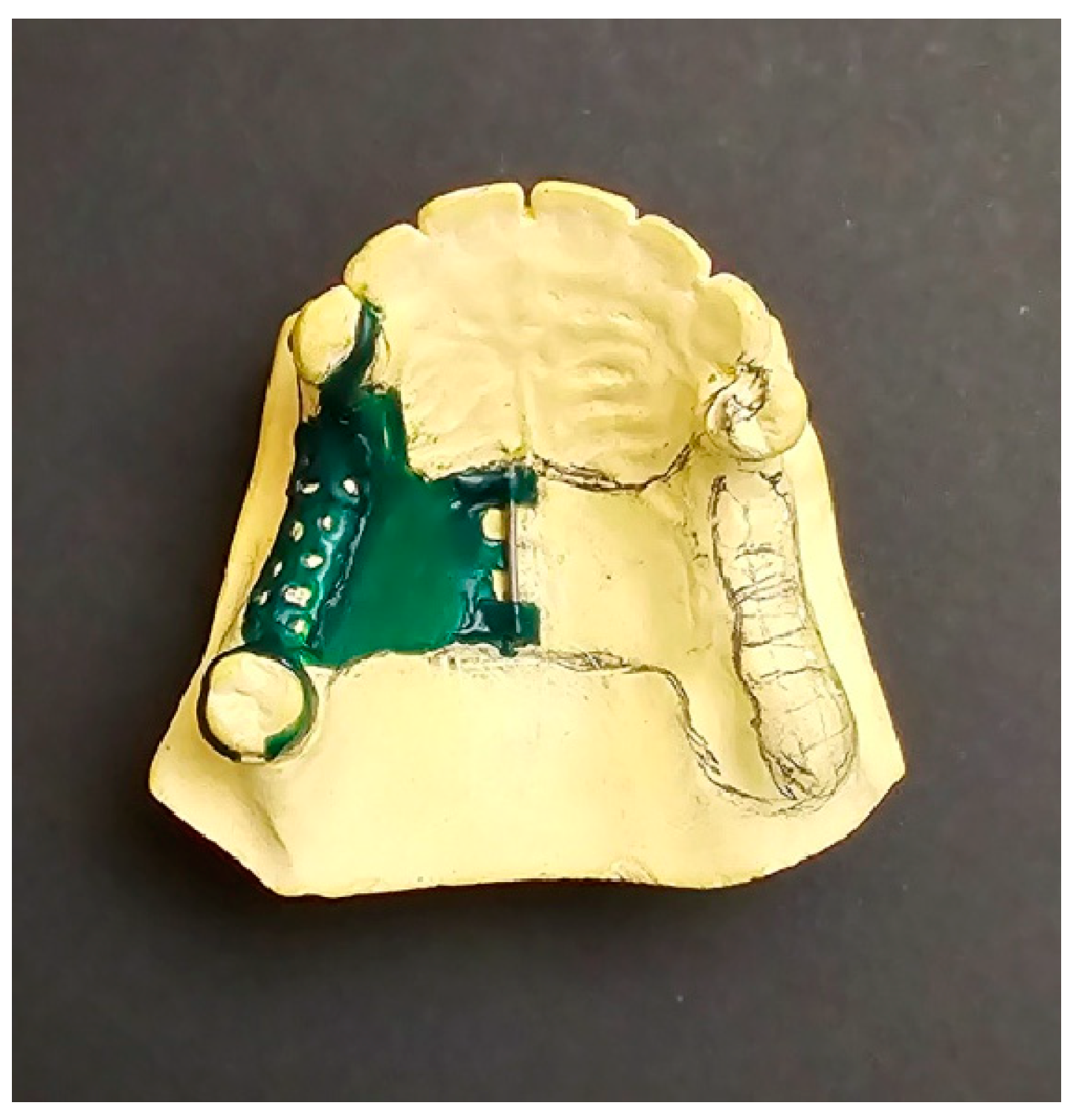 Prosthesis 06 00086 g002 Prosthesis 06 00086 g002