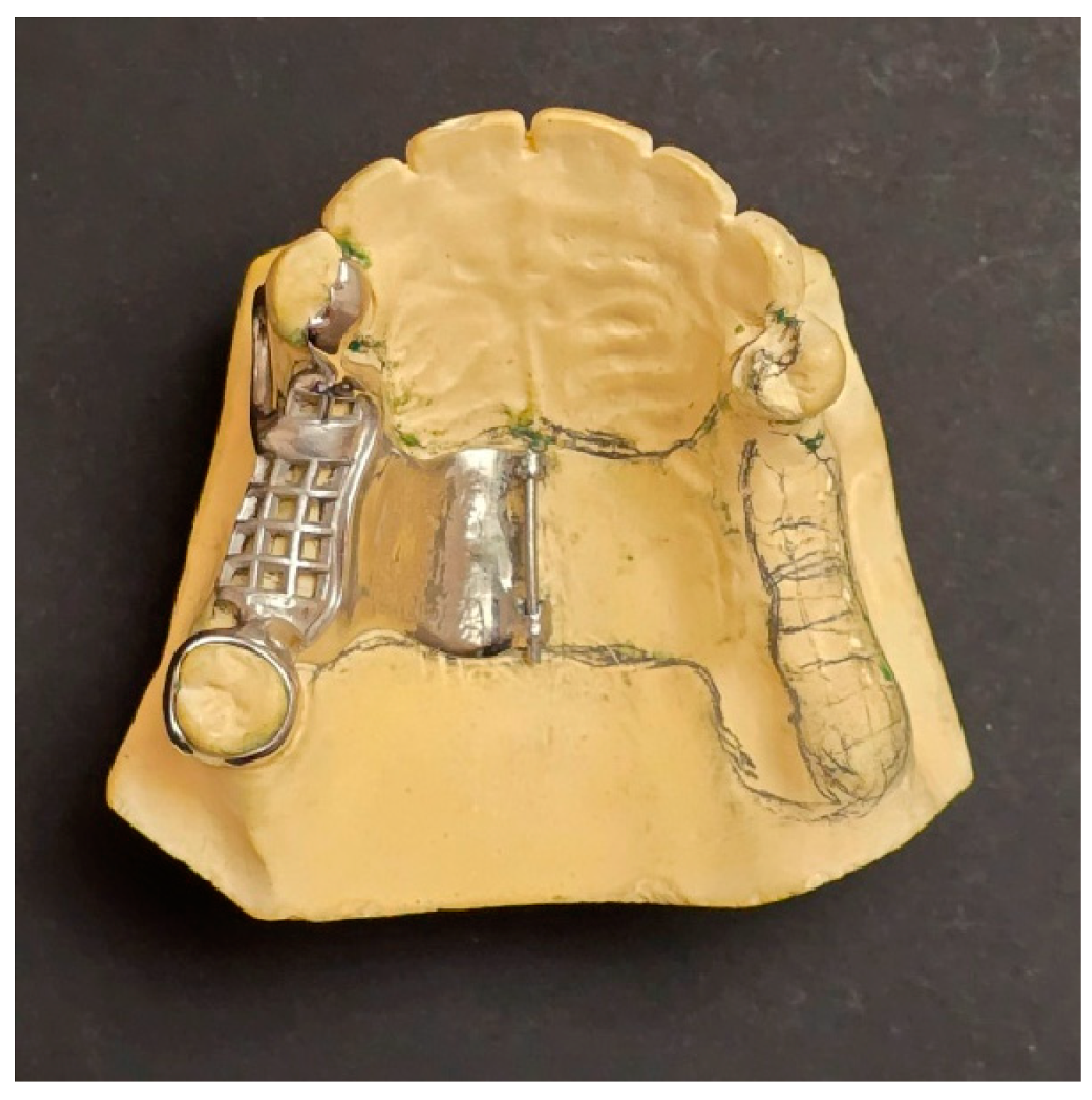 Prosthesis 06 00086 g003 Prosthesis 06 00086 g003