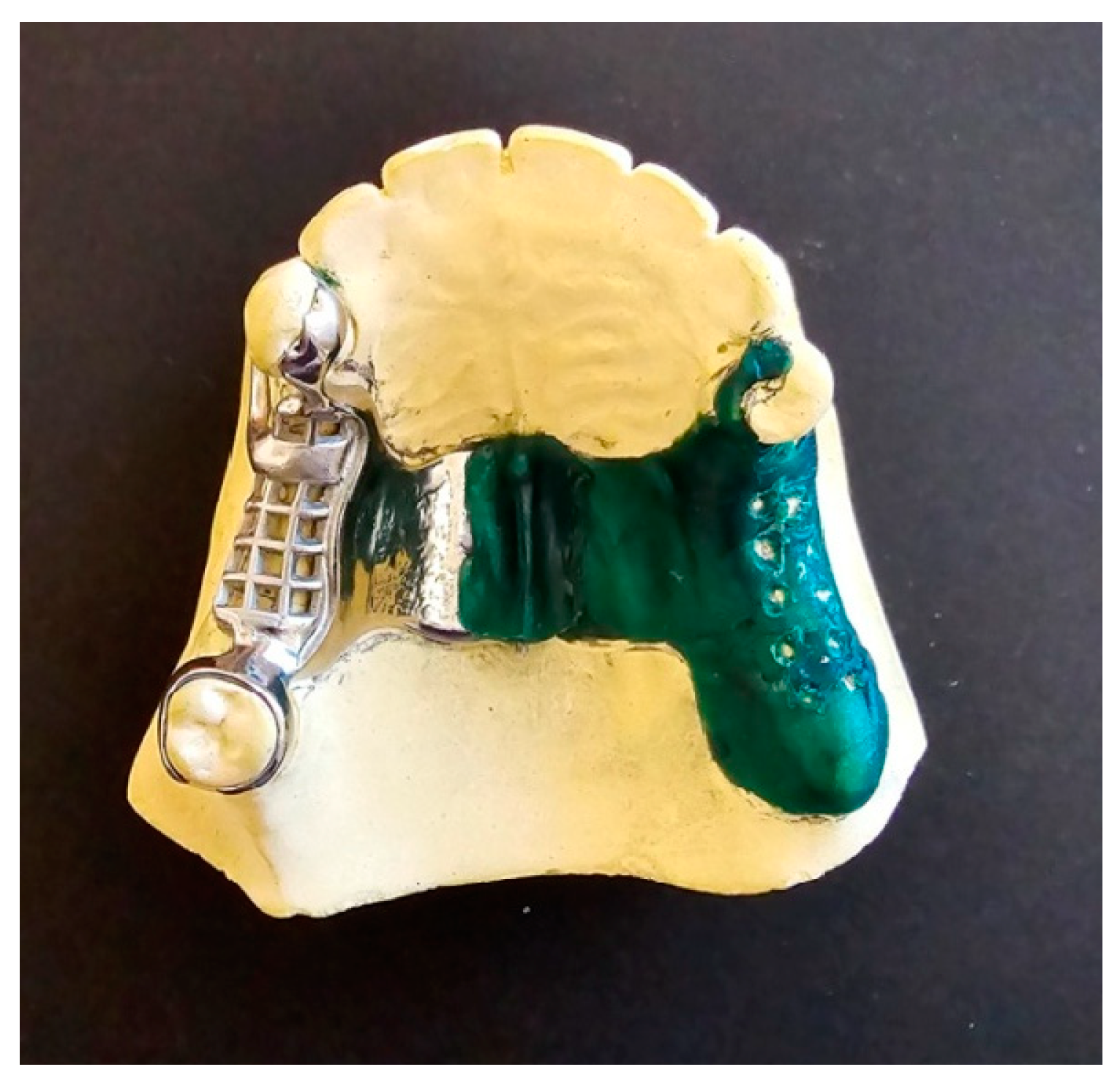 Prosthesis 06 00086 g005 Prosthesis 06 00086 g005